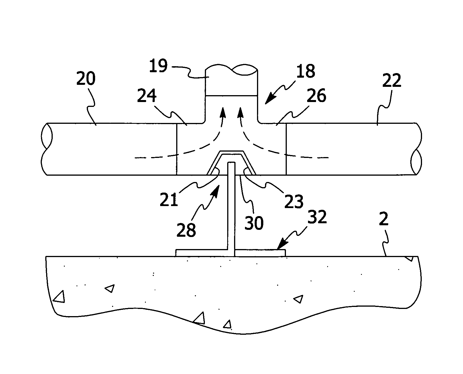Apparatus and method for removing materials from a material collection container