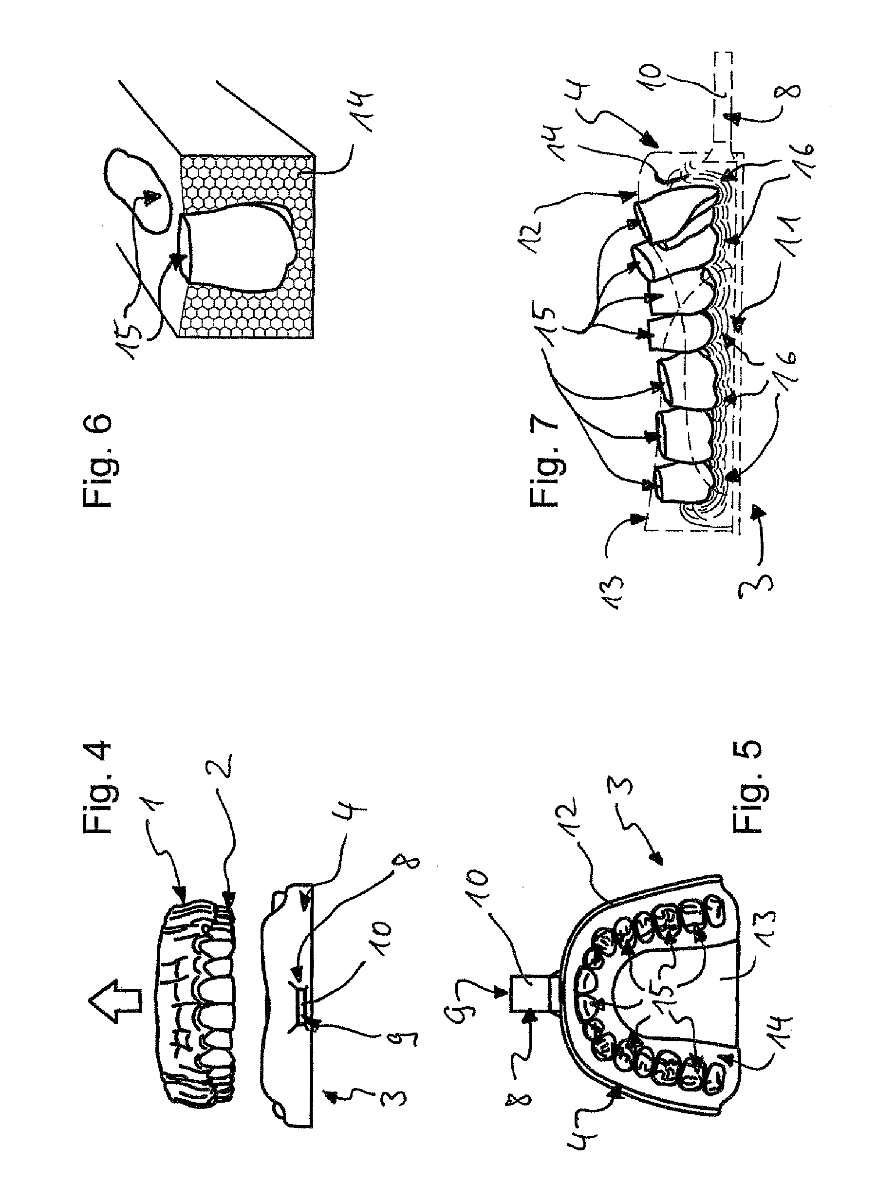 Impression tray, and method for capturing structures, arrangements or shapes, in particular in the mouth or human body