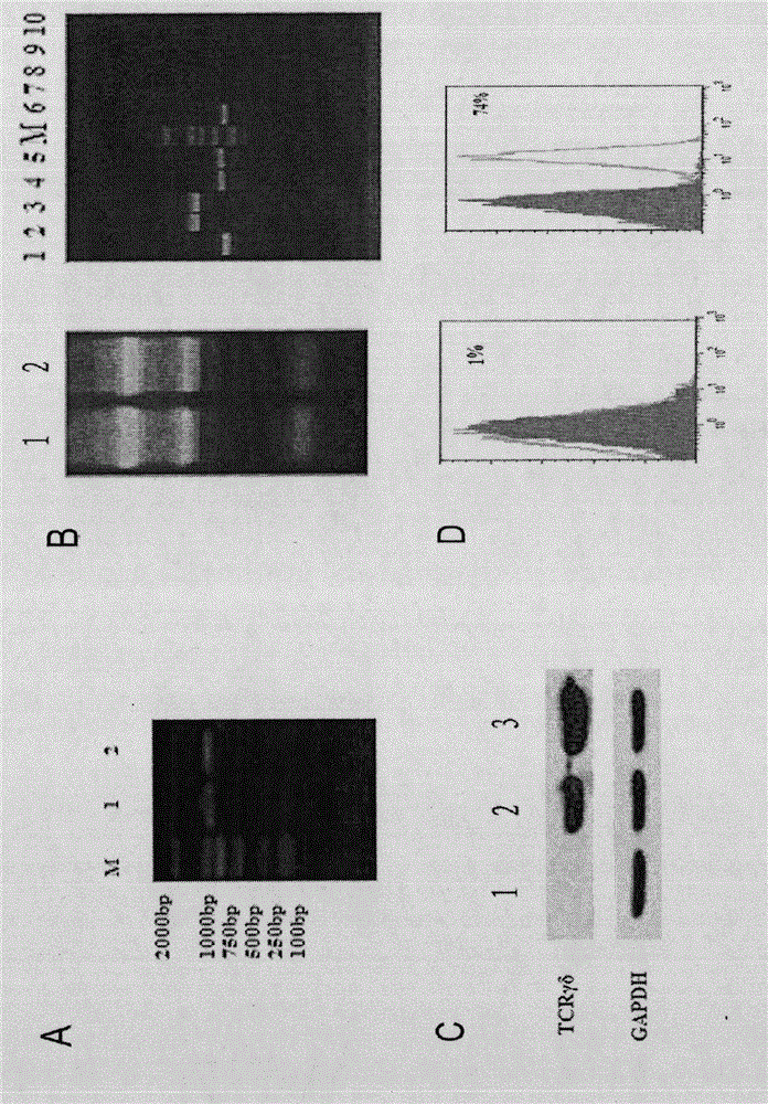 Gene modified CDR3 delta transplanted gamma delta T lymphocyte and its antitumor purpose