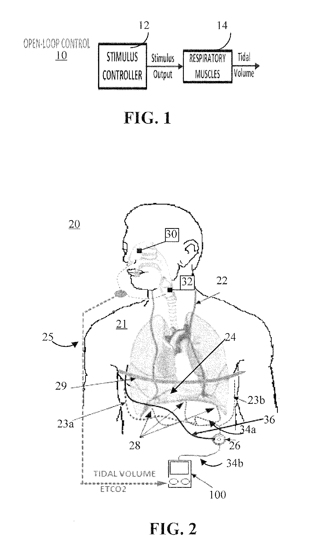 System and method for neuromorphic controlled adaptive pacing of respiratory muscles and nerves