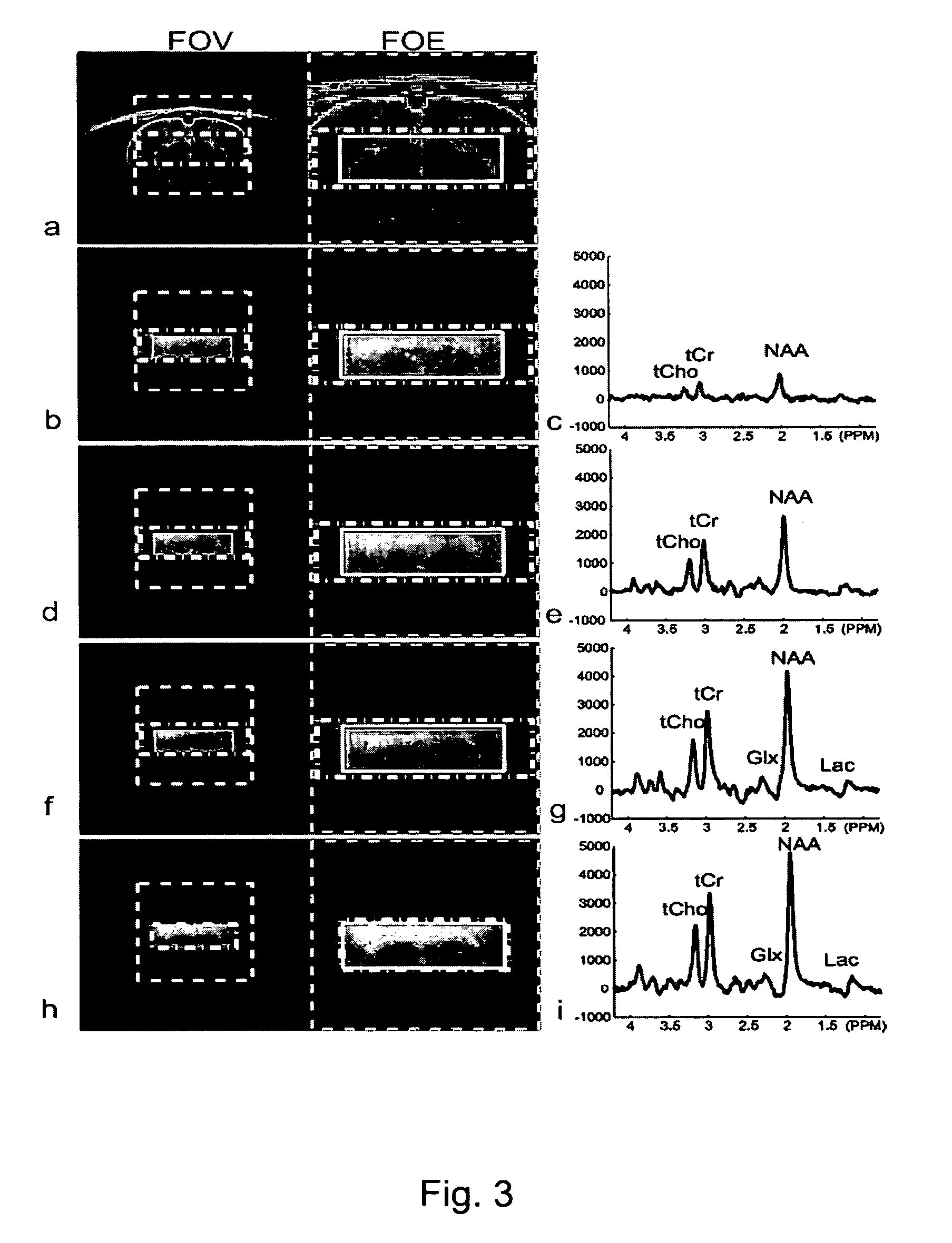 Methods for Arbitrary Shape Selective Excitation Summed Spectroscopy and Applications of Same