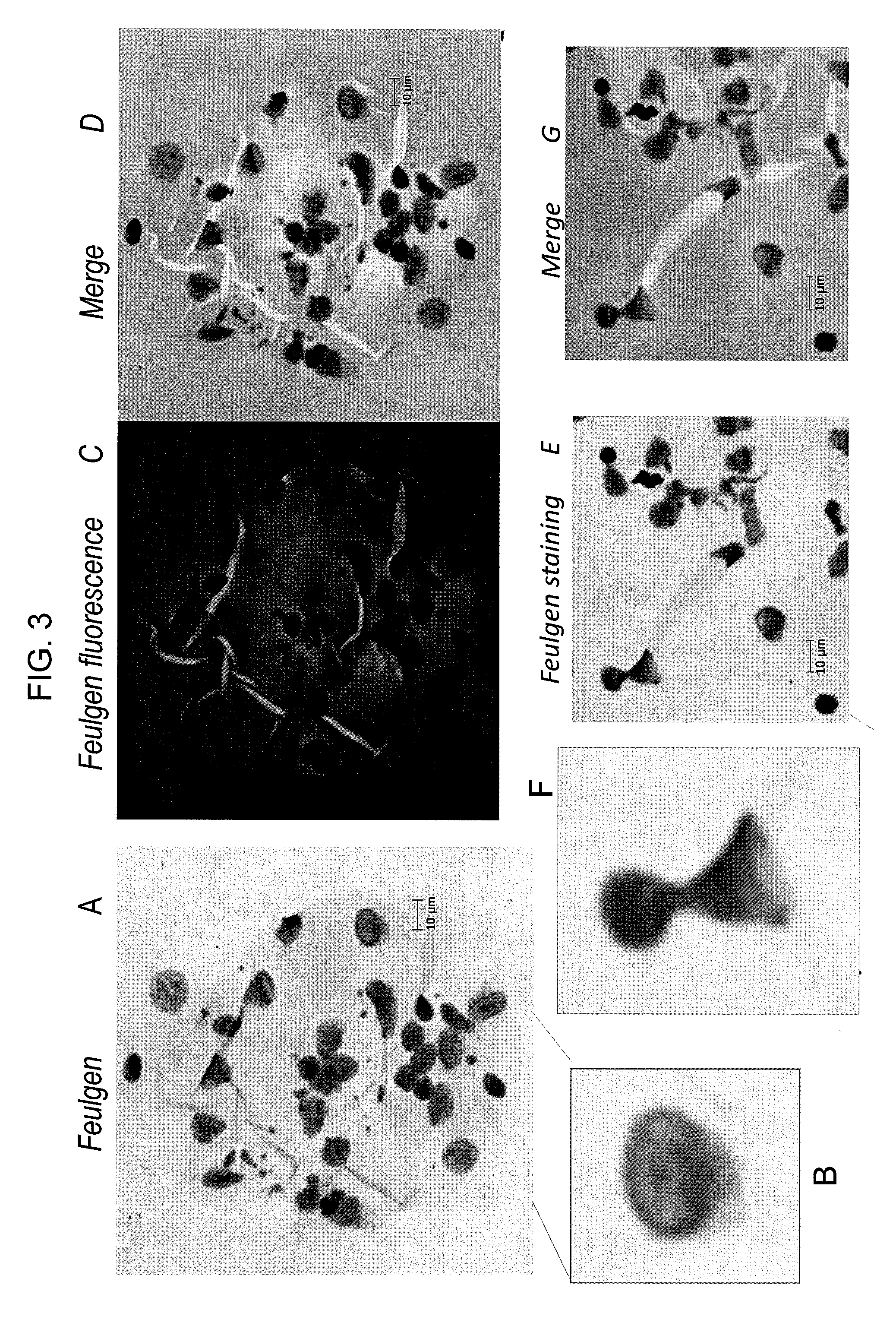 Wound healing metakaryotic stem cells and methods of use thereof