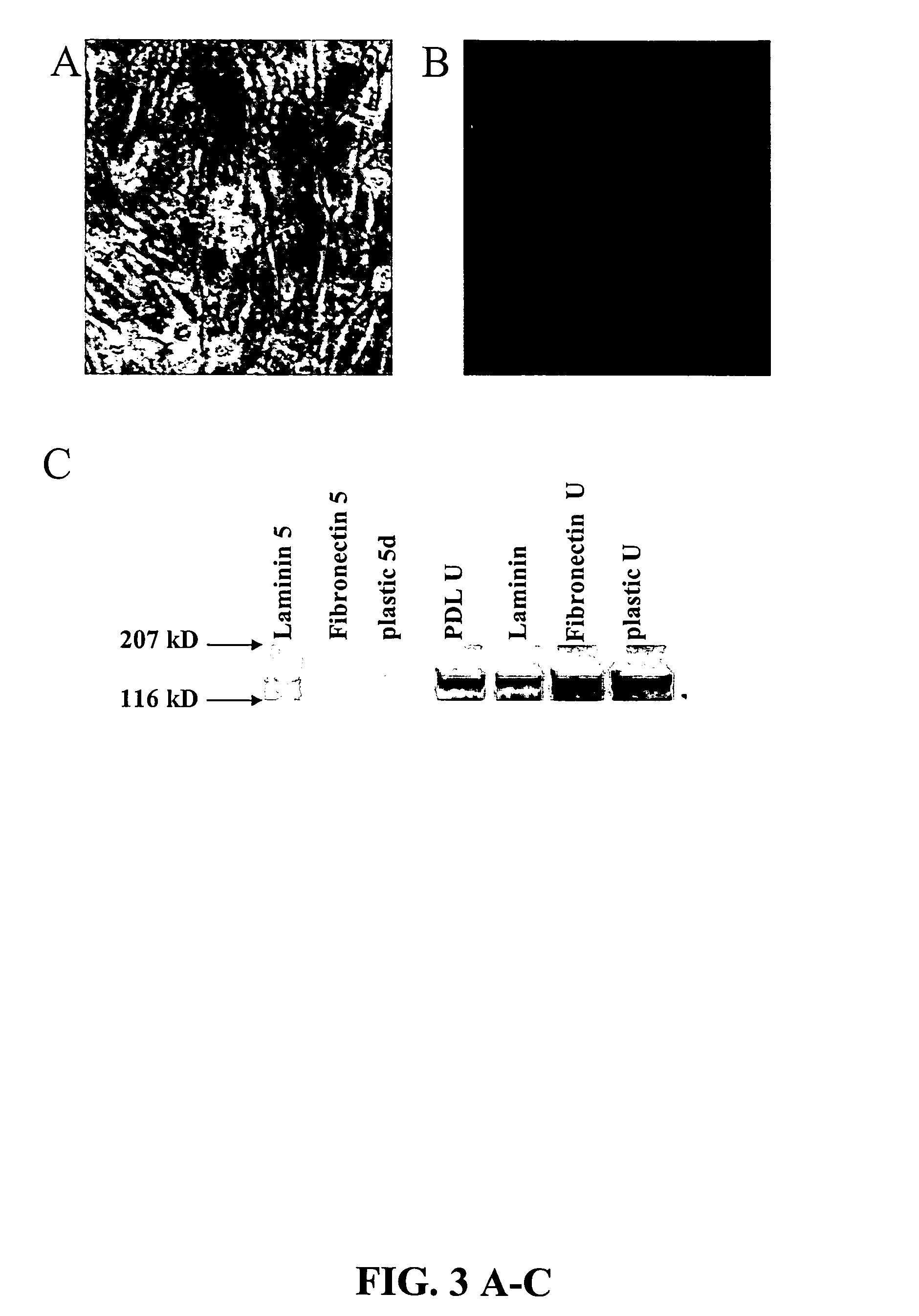 Cultures, products and methods using umbilical cord matrix cells