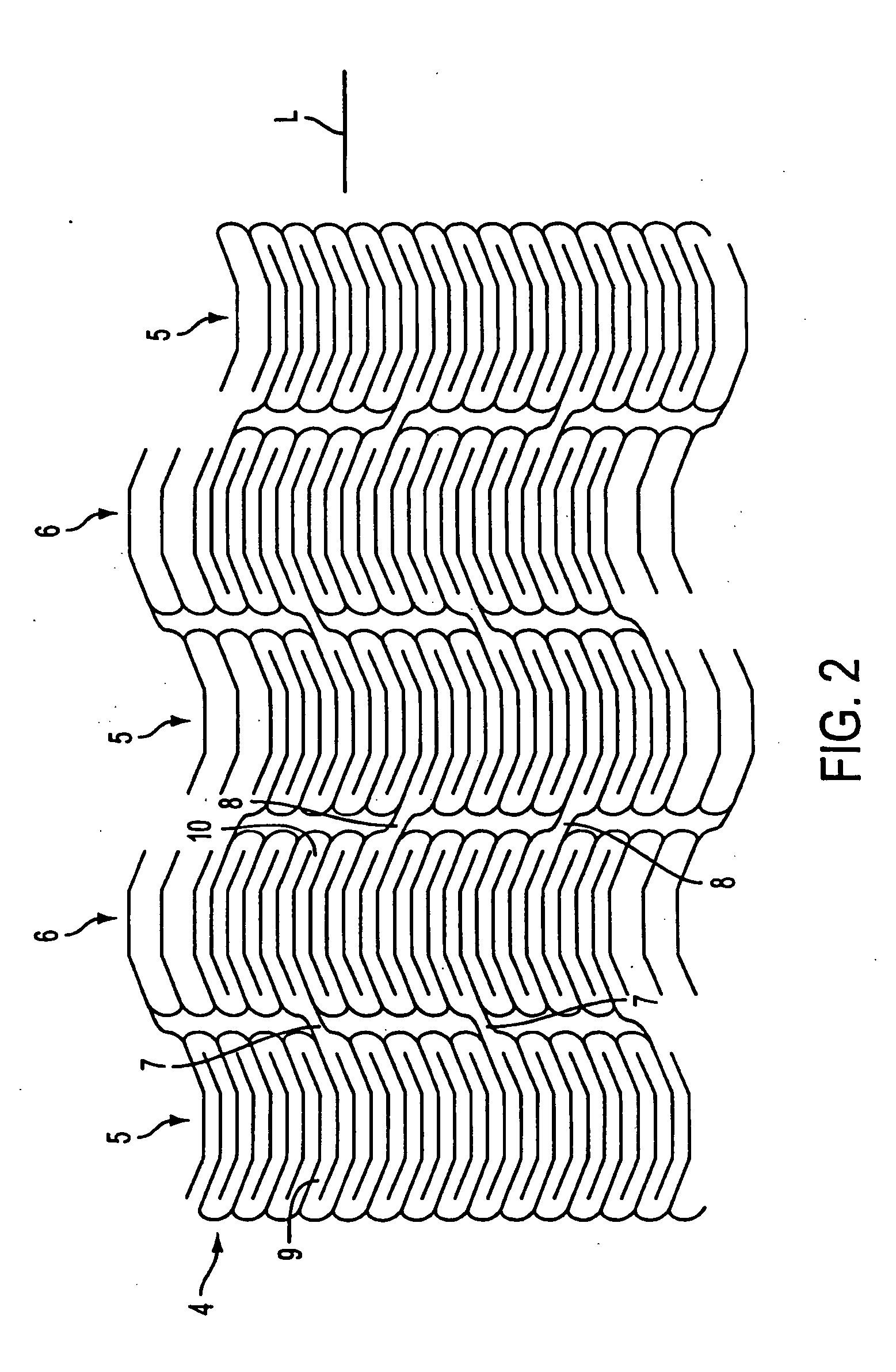 Methods and apparatus for a drug-coated stent having an expandable web structure