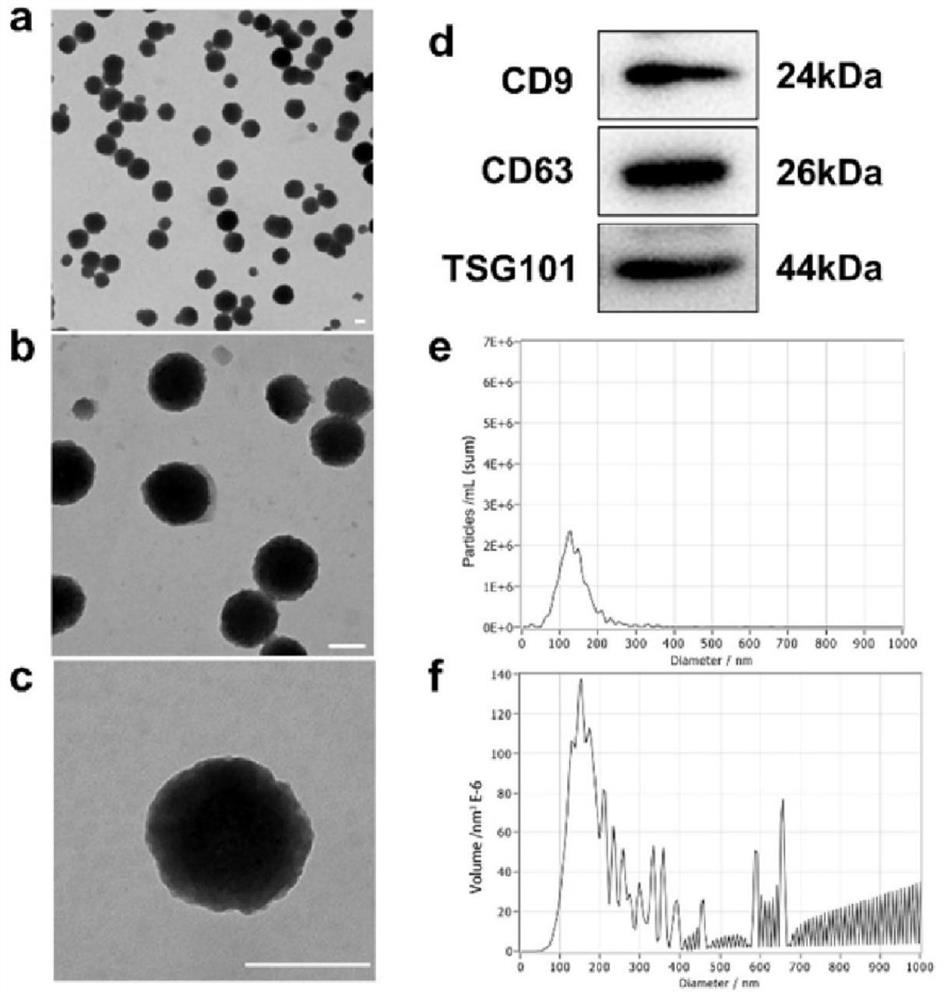 Preparation method and application of microneedle loaded with nano-motor driven exosome for treating enthesiopathy