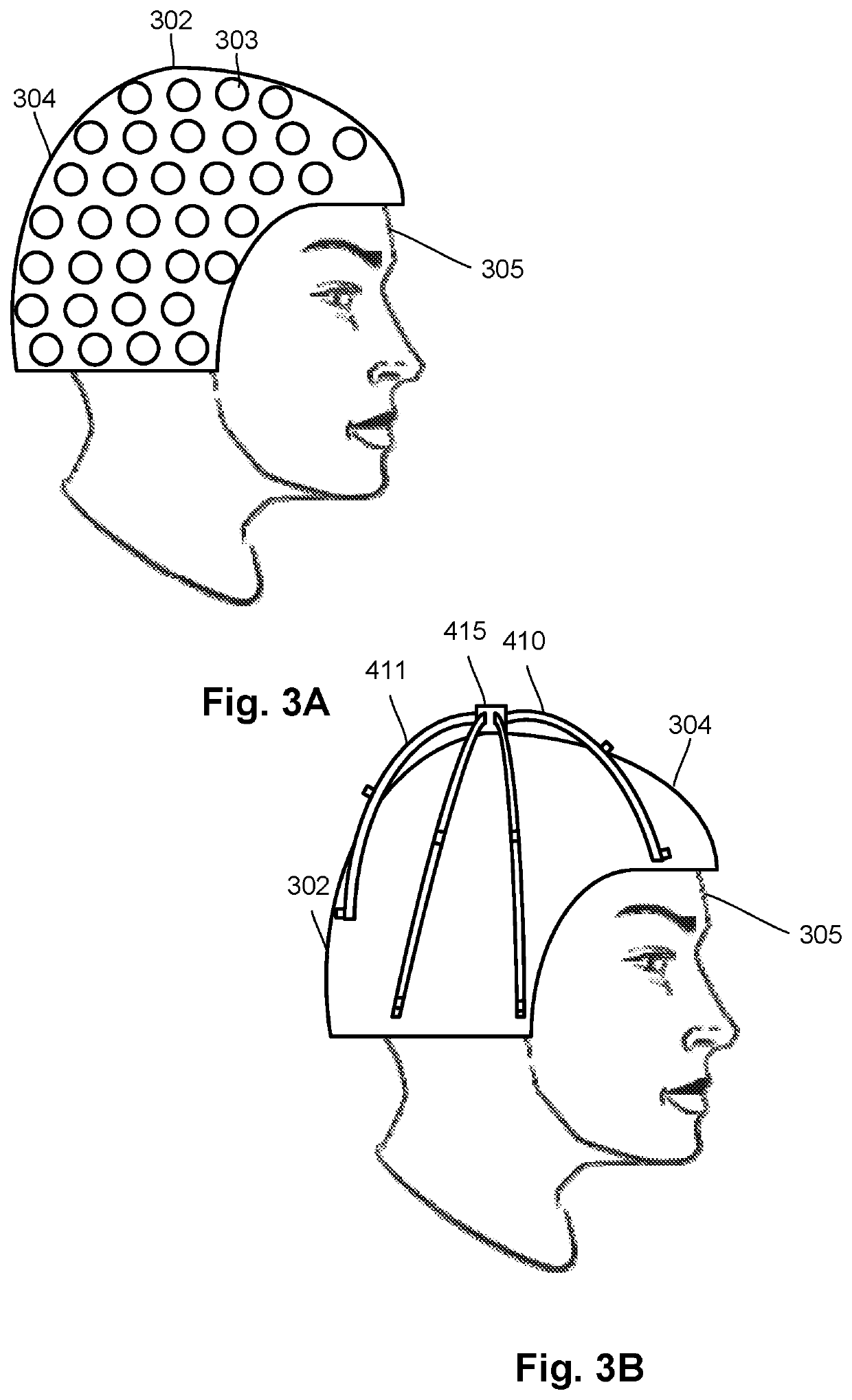 Detachable arrangement for on-scalp magnetoencephalography (MEG) calibration