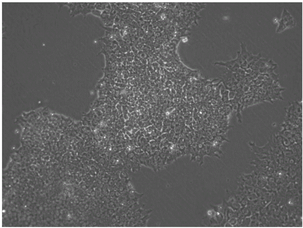 Kit and method for in-vitro directionally differentiating human-derived iPS stem cells into nerve cells