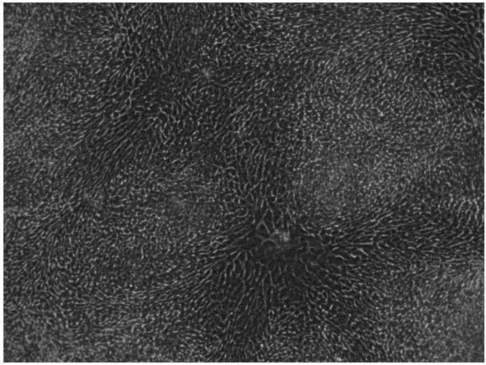 Kit and method for in-vitro directionally differentiating human-derived iPS stem cells into nerve cells