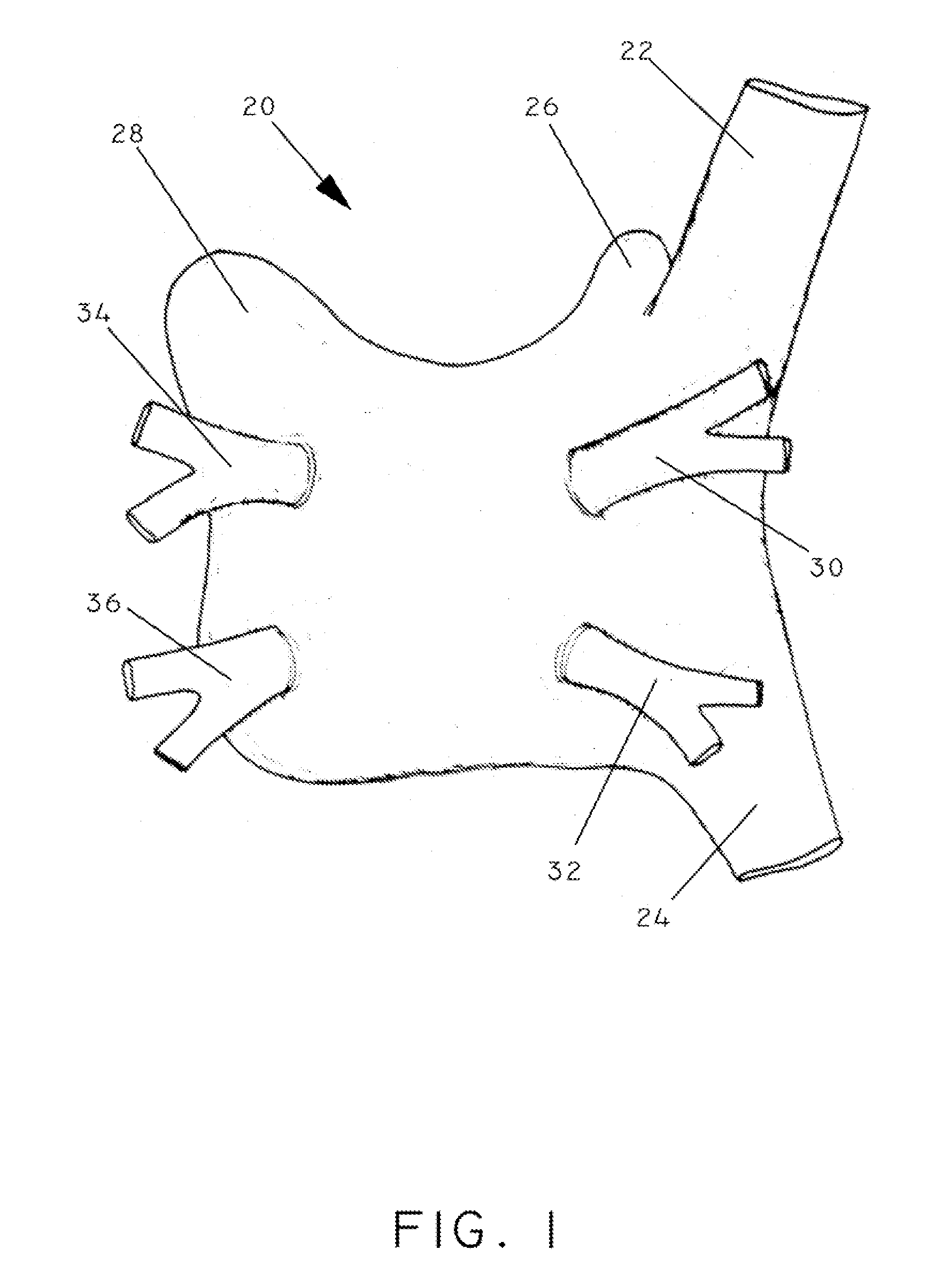 High Frequency Stimulation for Treatment of Atrial Fibrillation