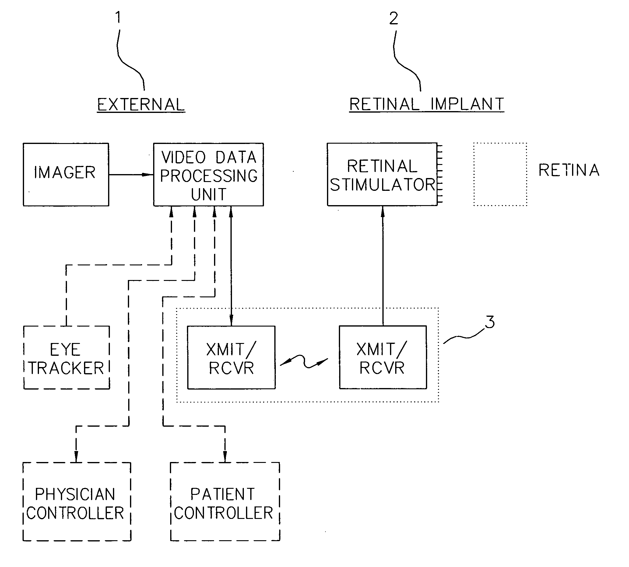 Visual prosthesis with user interface