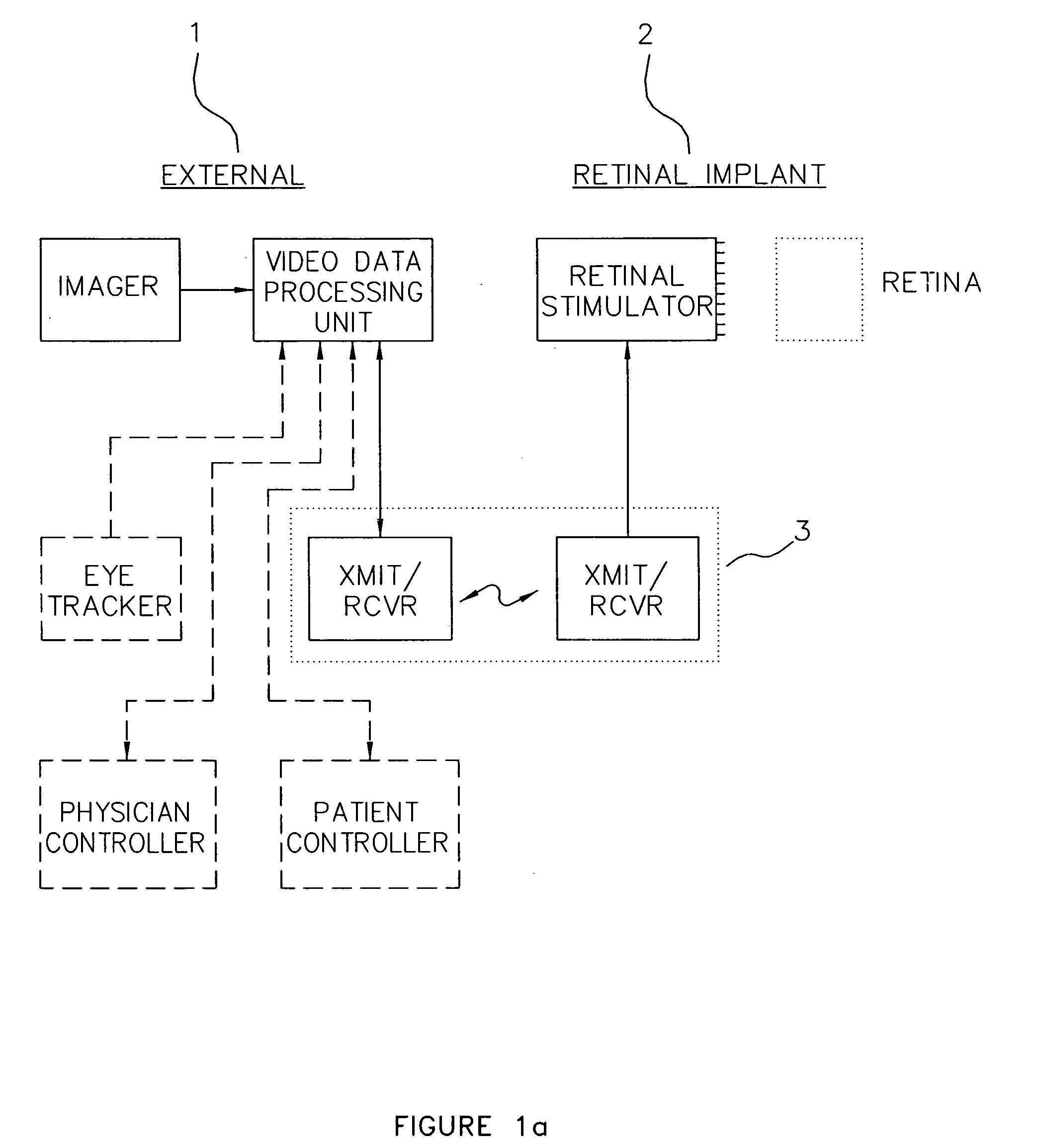 Visual prosthesis with user interface