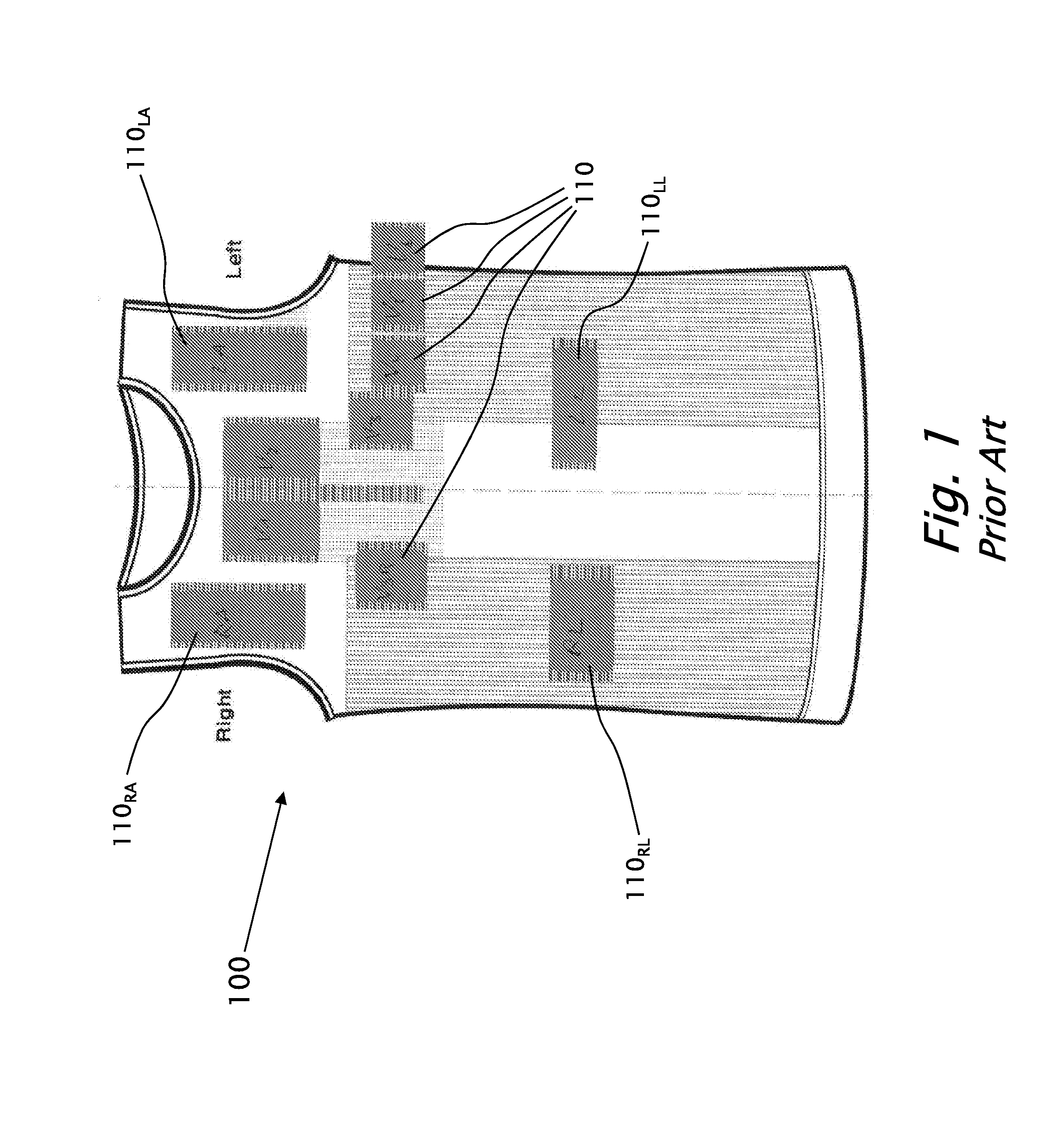 Devices and methods for obtaining workable ECG signals using dry knitted electrodes