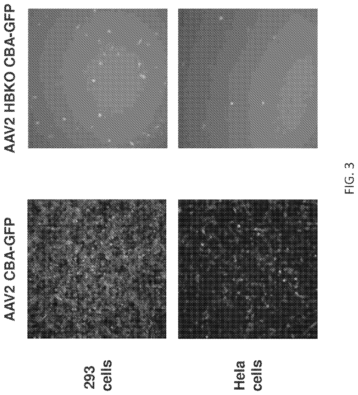 AAV vectors for retinal and CNS gene therapy