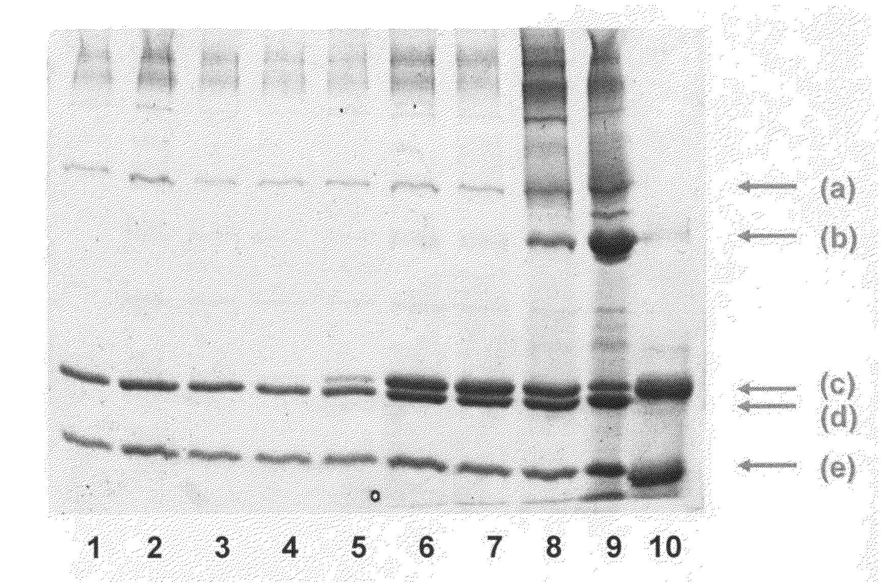 Method for Concentrating, Purifying and Removing Prion Protein