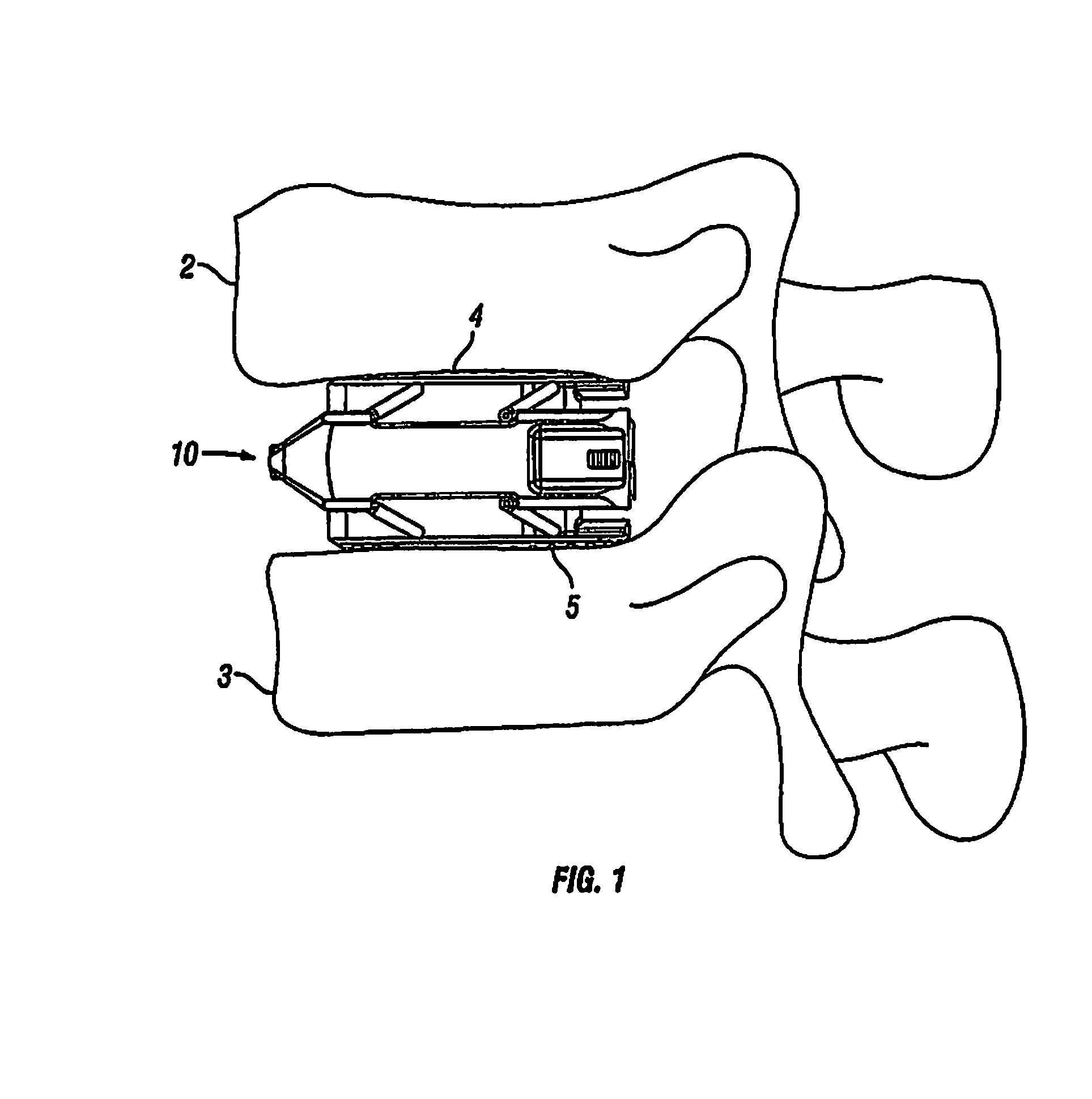 Expandable Fusion Device and Method of Installation Thereof