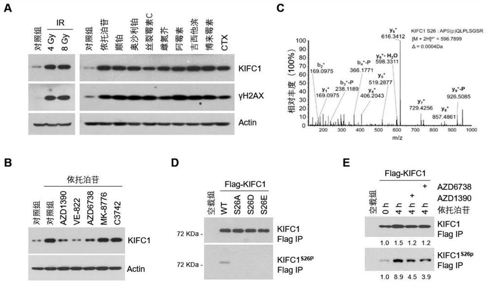 Marker KIFC1 for predicting drug resistance and recurrence of tumors and inhibitor thereof and use of marker KIFC1 and inhibitor thereof