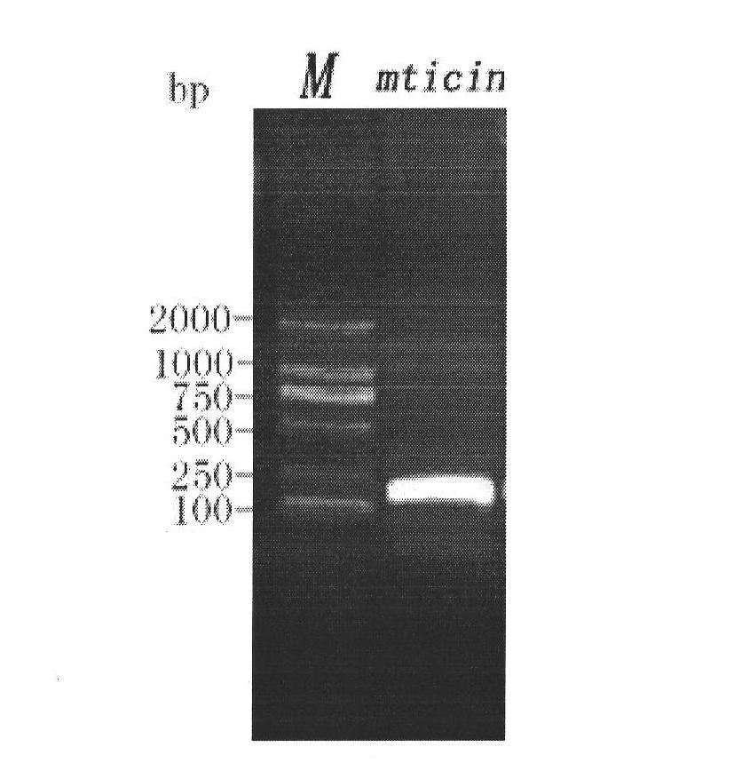 Mytilus coruscus antibacterial peptide and preparation method and application thereof