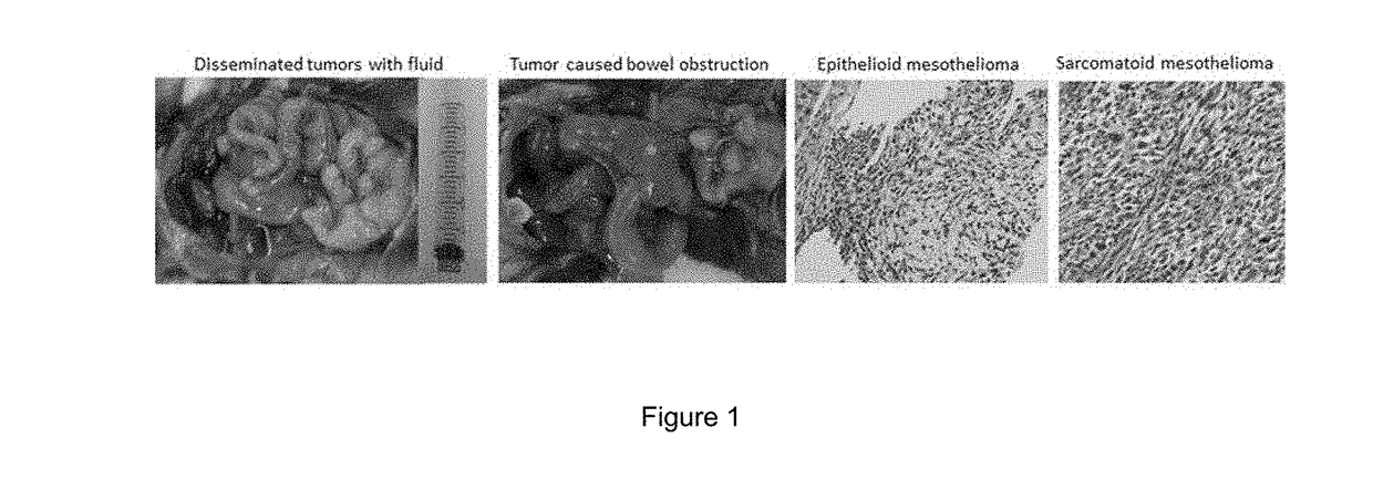 Methods for the Treatment and Prevention of Asbestos-Related Diseases