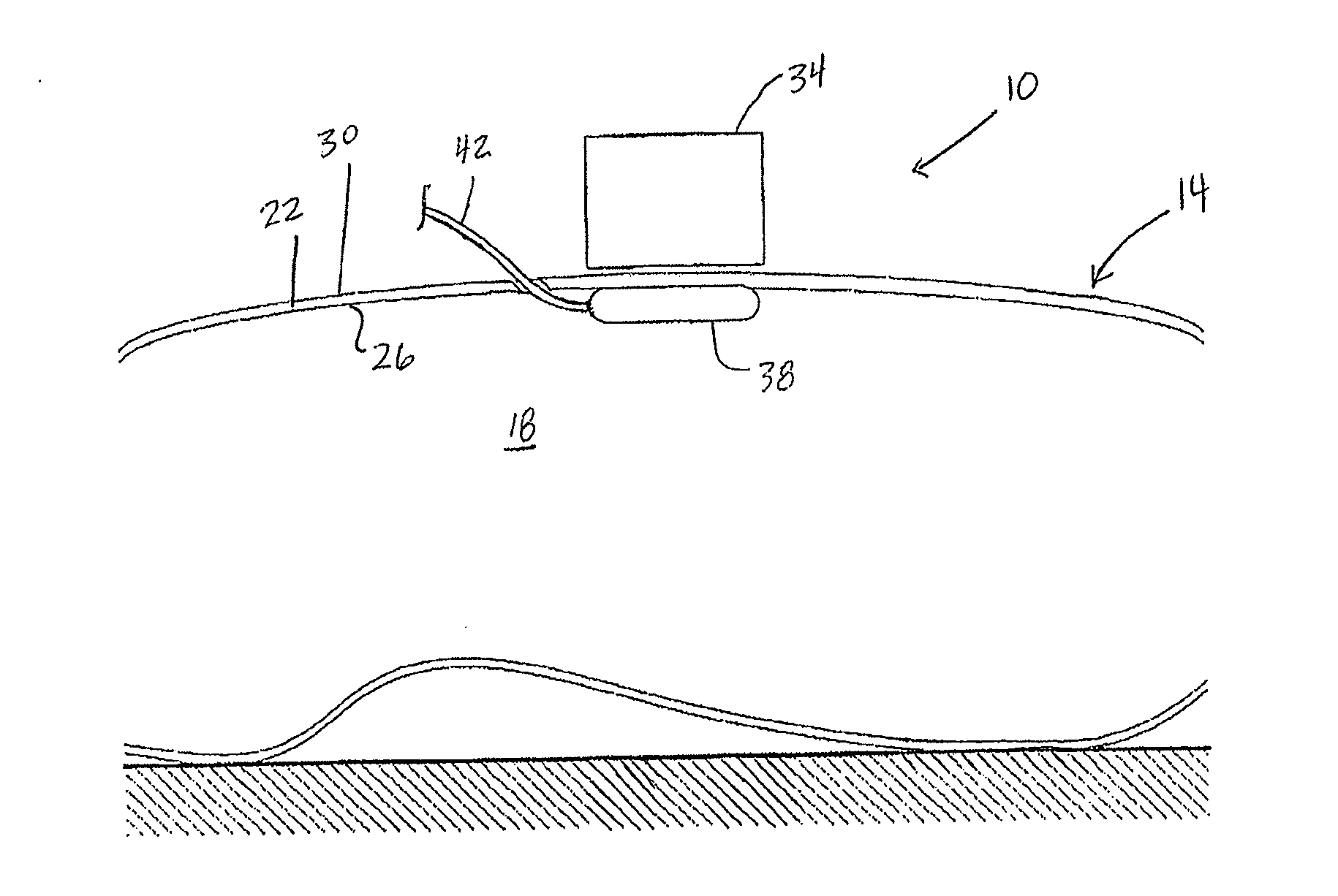 Apparatuses, systems, and methods for use and transport of magnetic medical devices with transport fixtures or safety cages