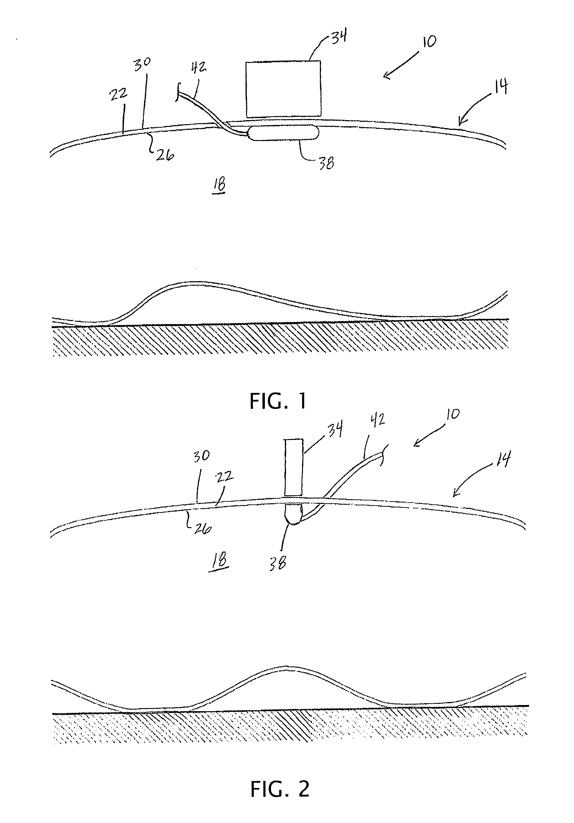 Apparatuses, systems, and methods for use and transport of magnetic medical devices with transport fixtures or safety cages