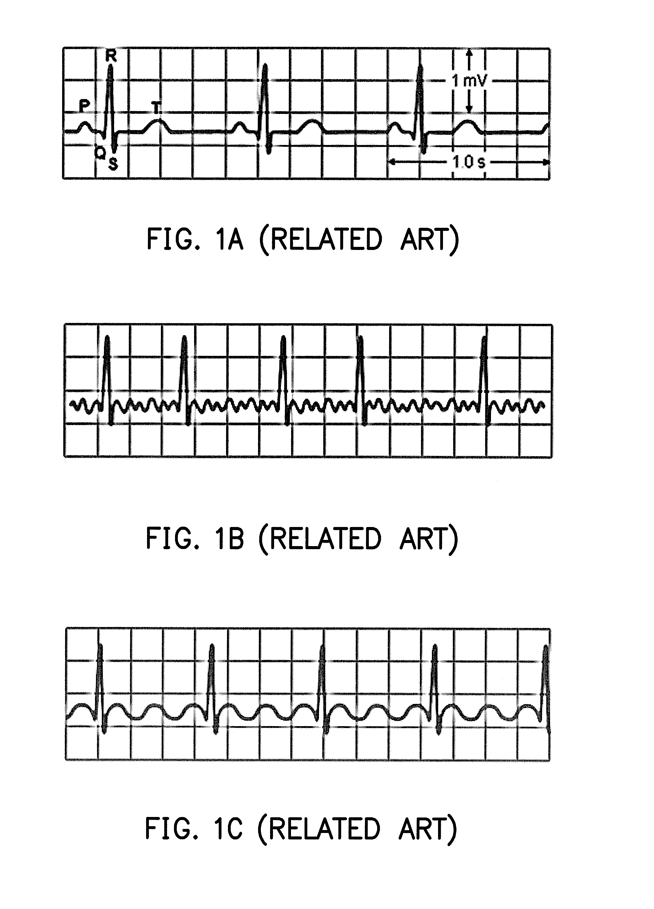 Method, electronic apparatus, and computer readable medium of constructing classifier for disease detection