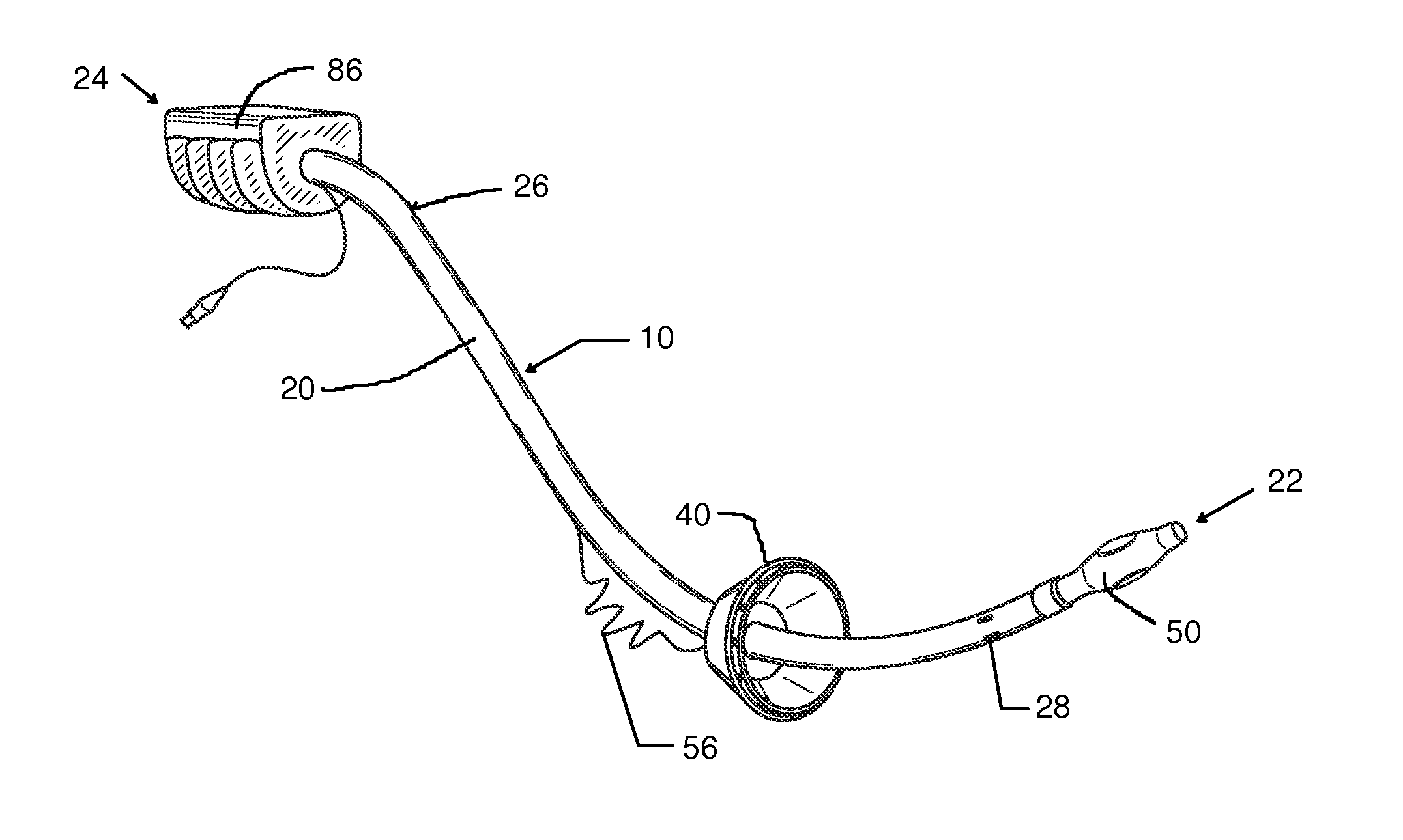 Tissue Removal and Manipulator Device for LAVH and Related Surgeries