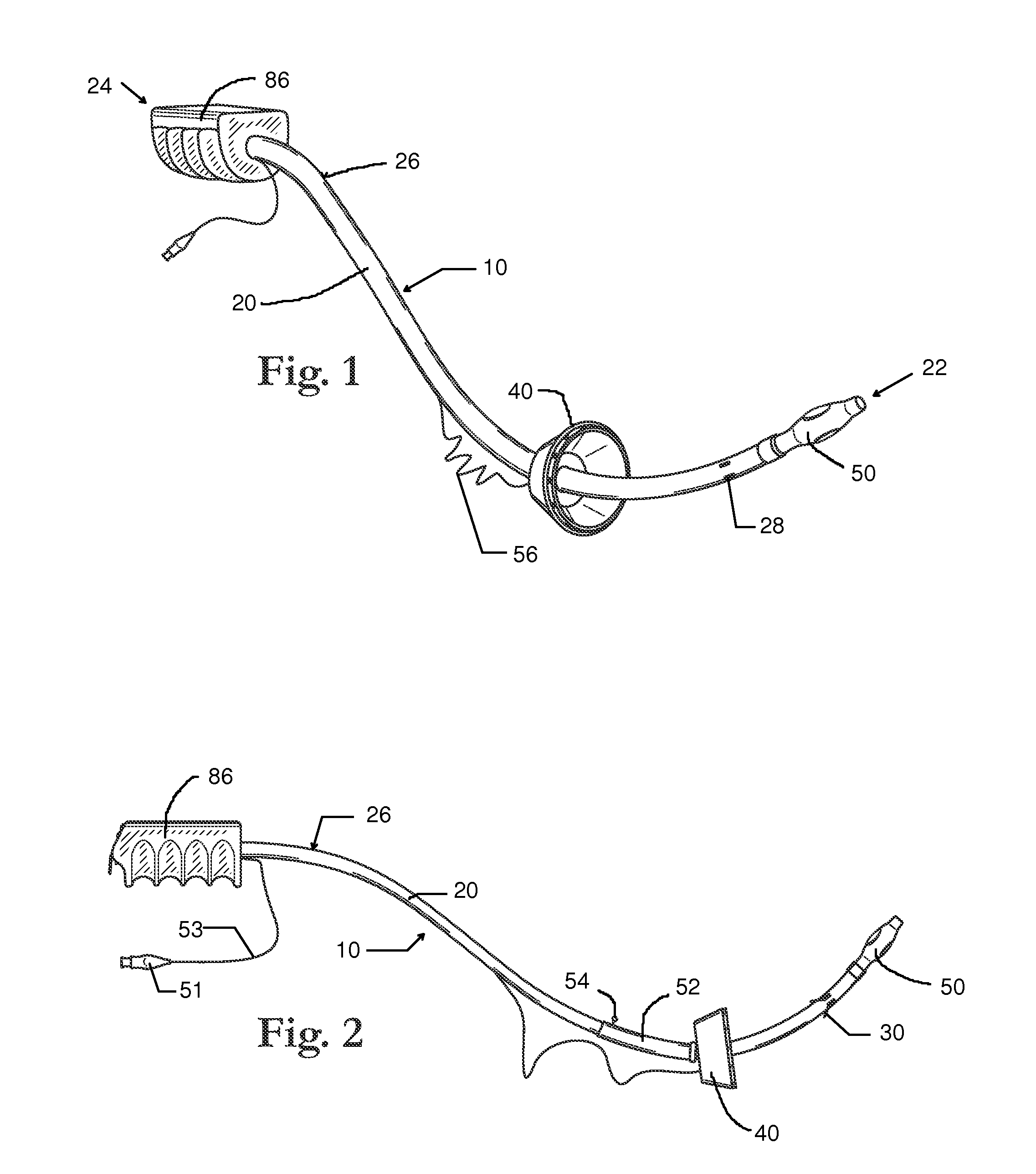 Tissue Removal and Manipulator Device for LAVH and Related Surgeries