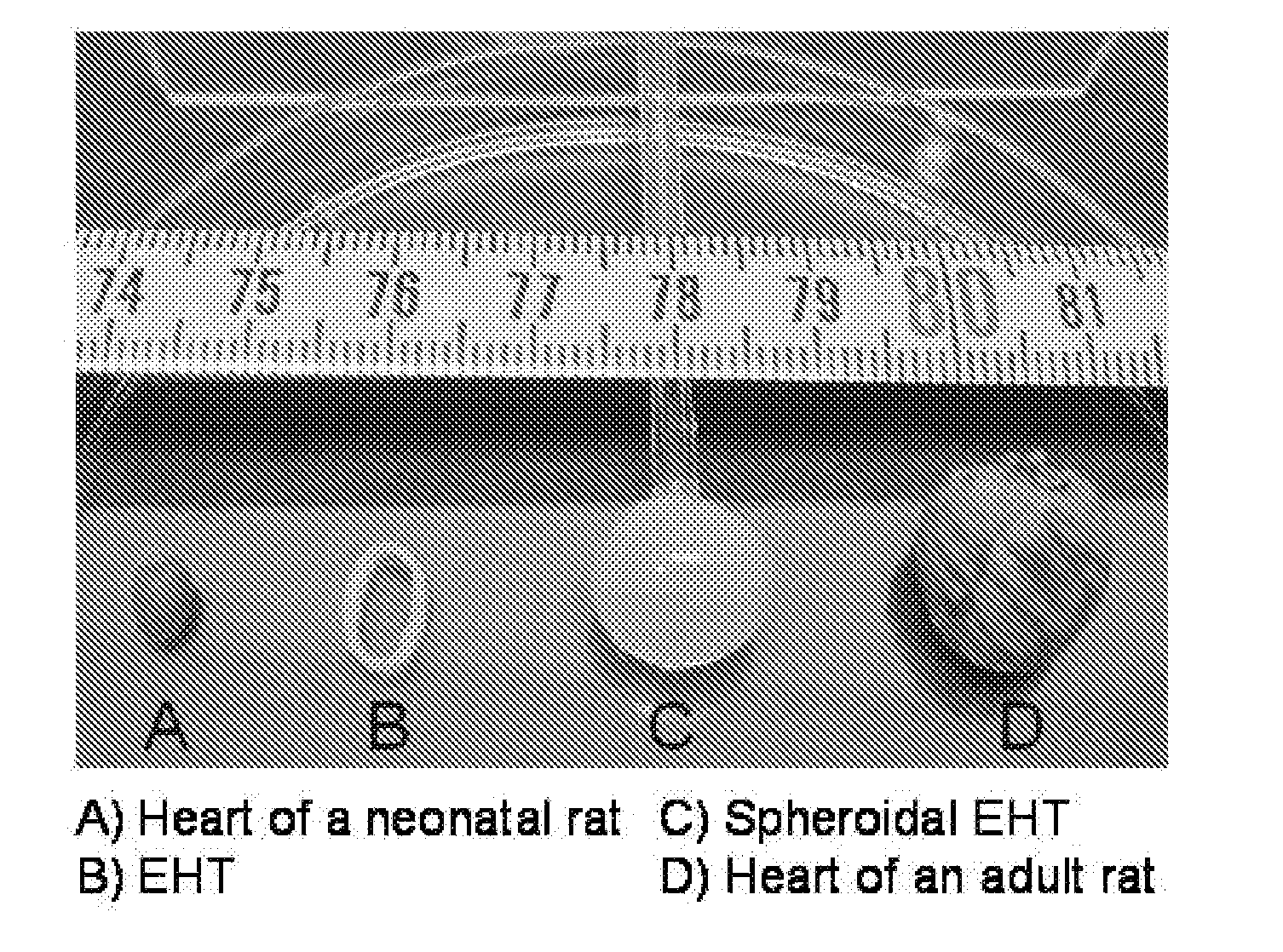 Pouch-Like Construct for Preventing Heart Distension