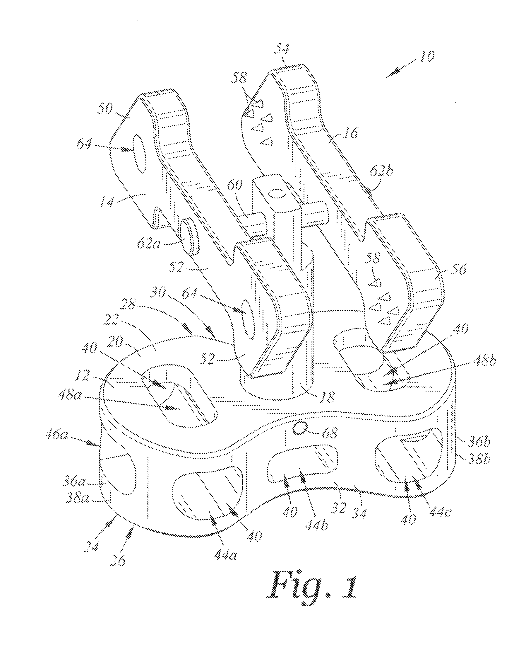 Spinal implant device with fusion cage and fixation plates and method of implanting