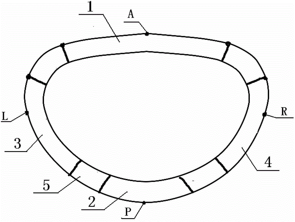 mitral annuloplasty ring