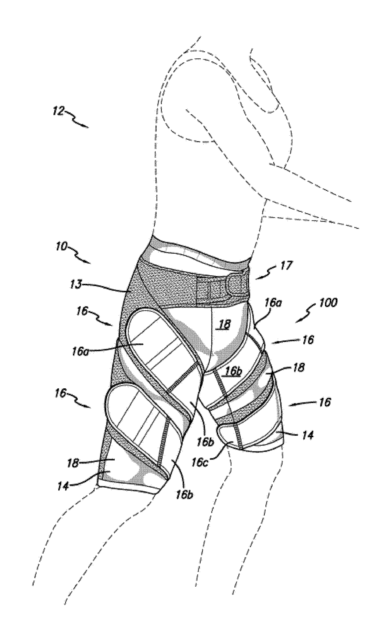 An Orthotic for Muscle Imbalance and Posture Correction and Lumbopelvic Support