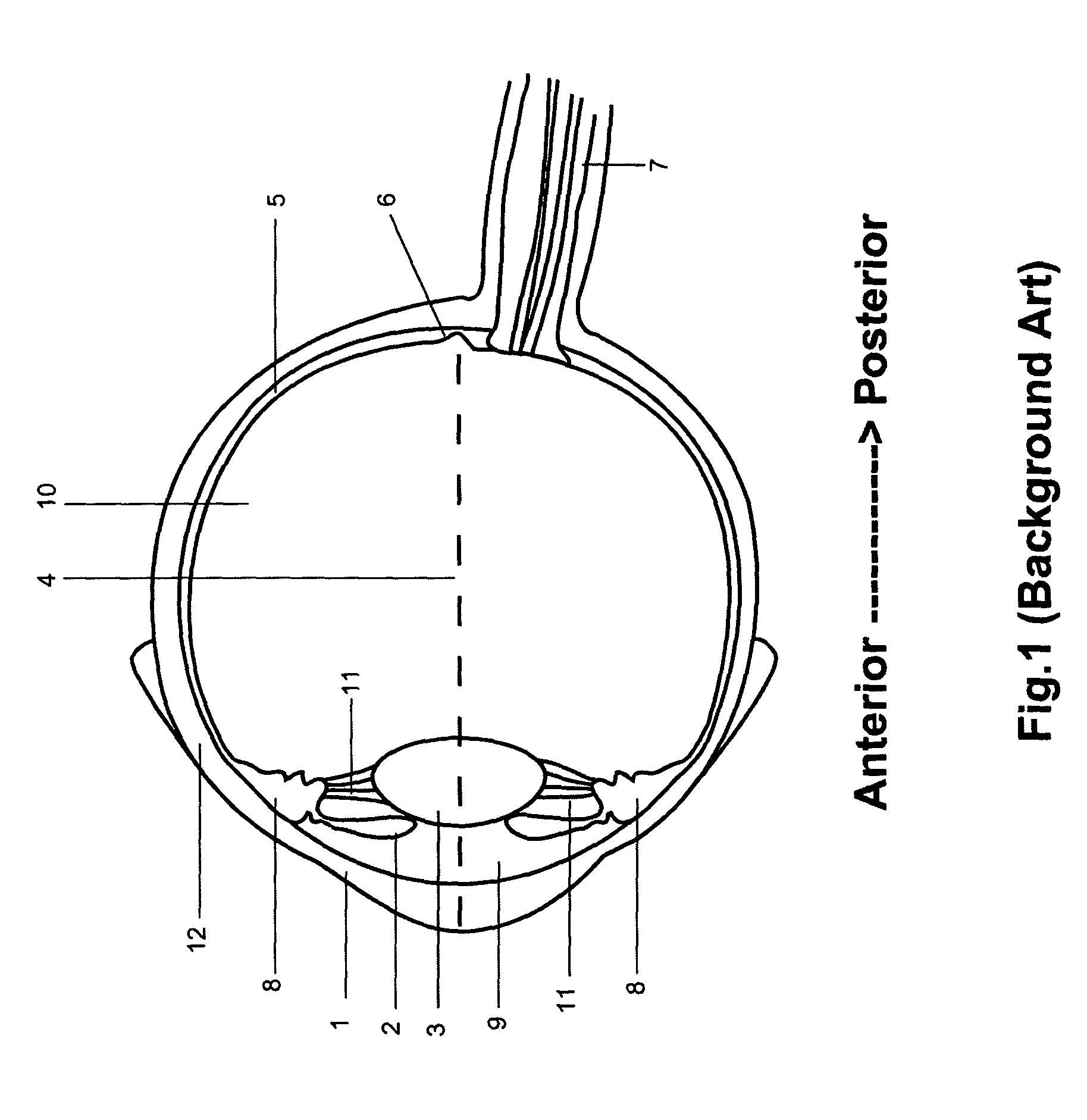Method and a system for laser photoablation within a lens