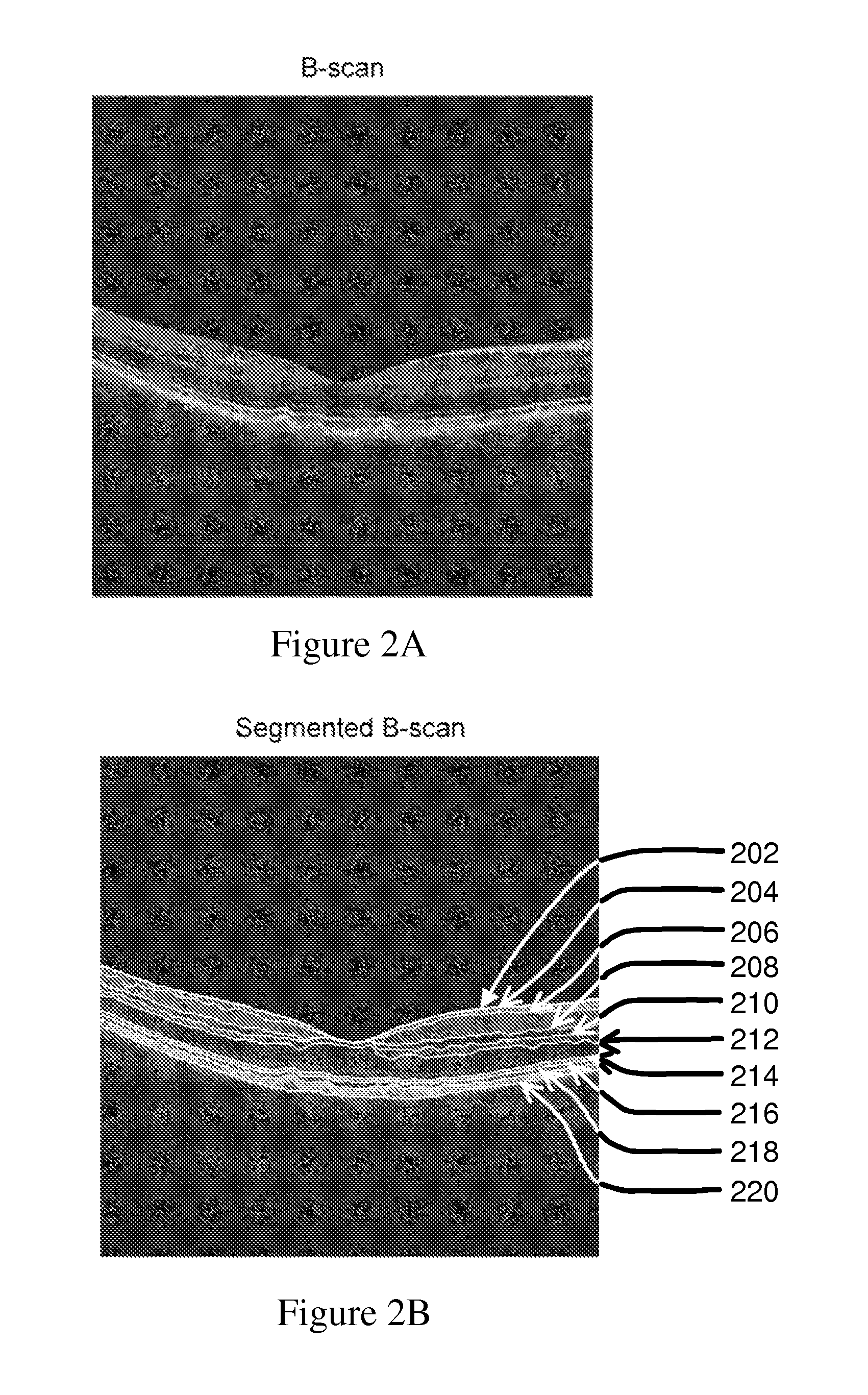 Method and System for Evaluating Progression of Age-Related Macular Degeneration