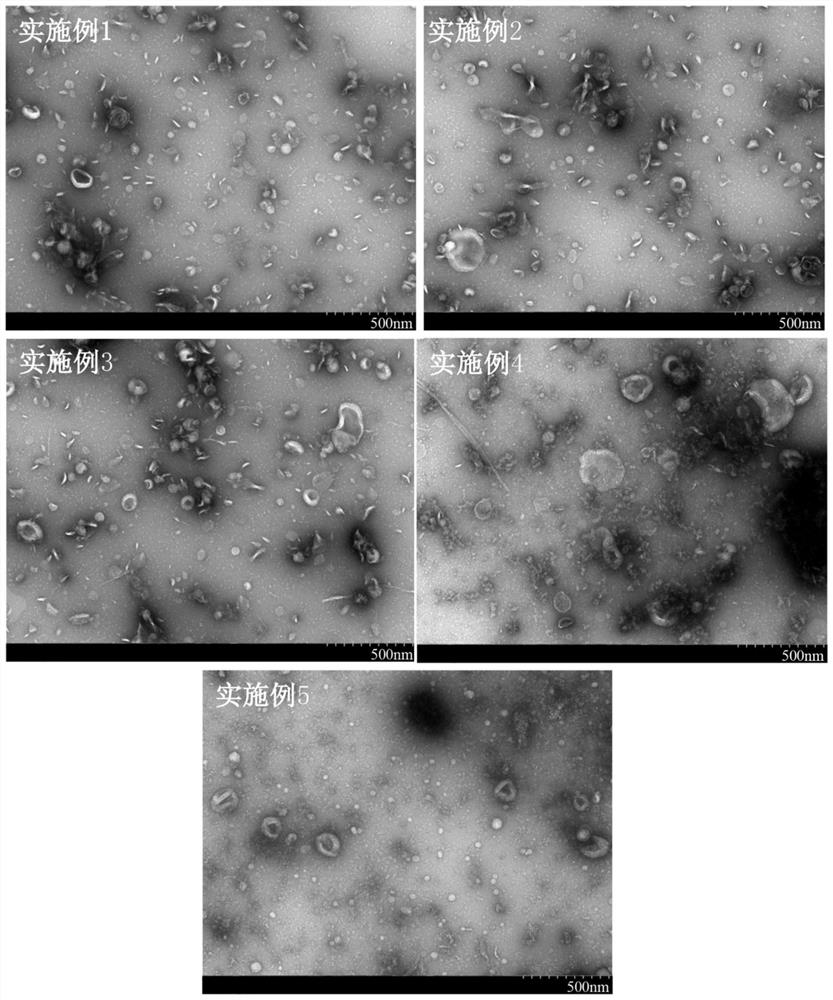 Purification method of plant exosome