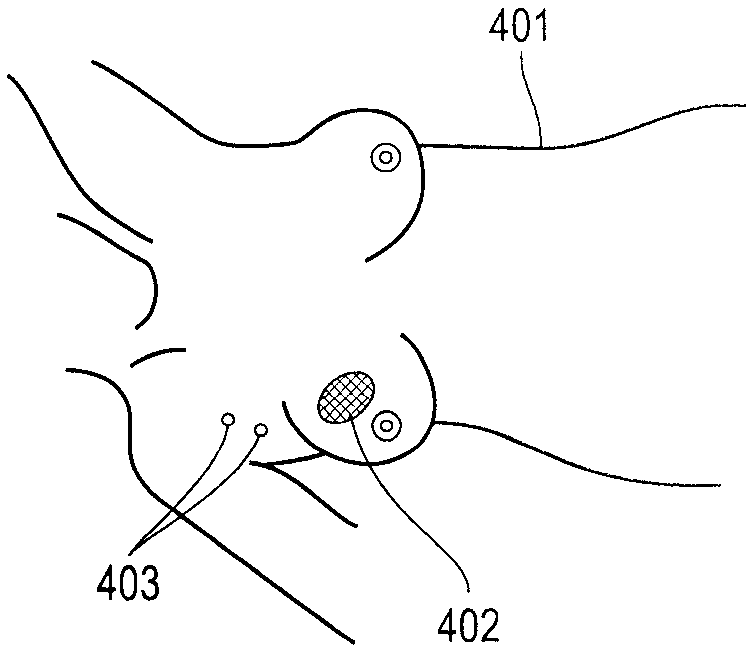 Combined radiationless automated three dimensional patient habitus imaging with scintigraphy