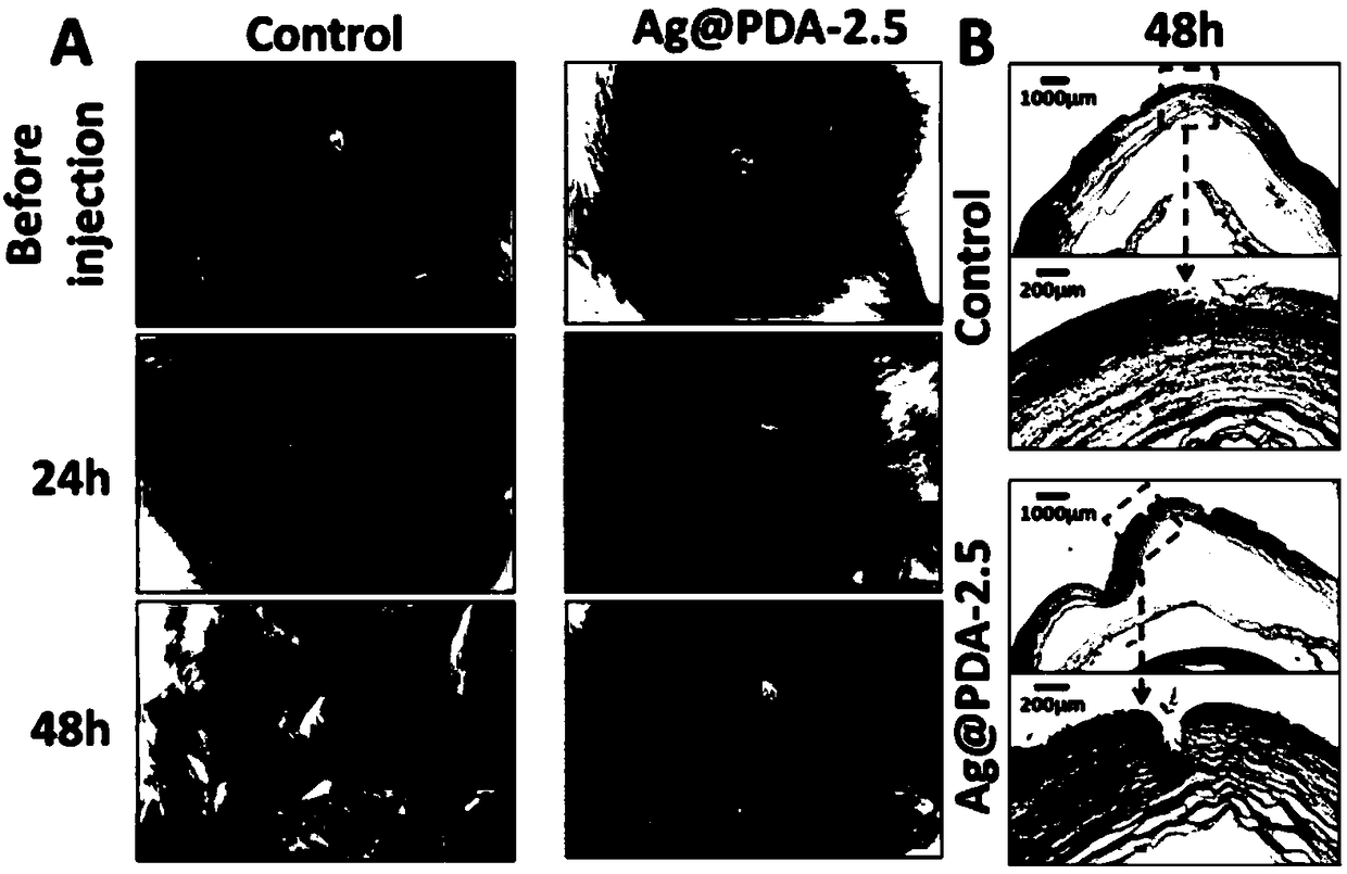 Preparation method for antibacterial contact lens