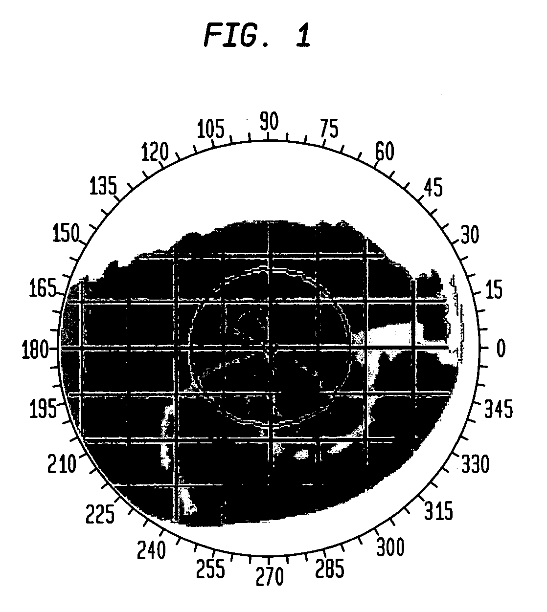 Local average curvature map for corneal topographers