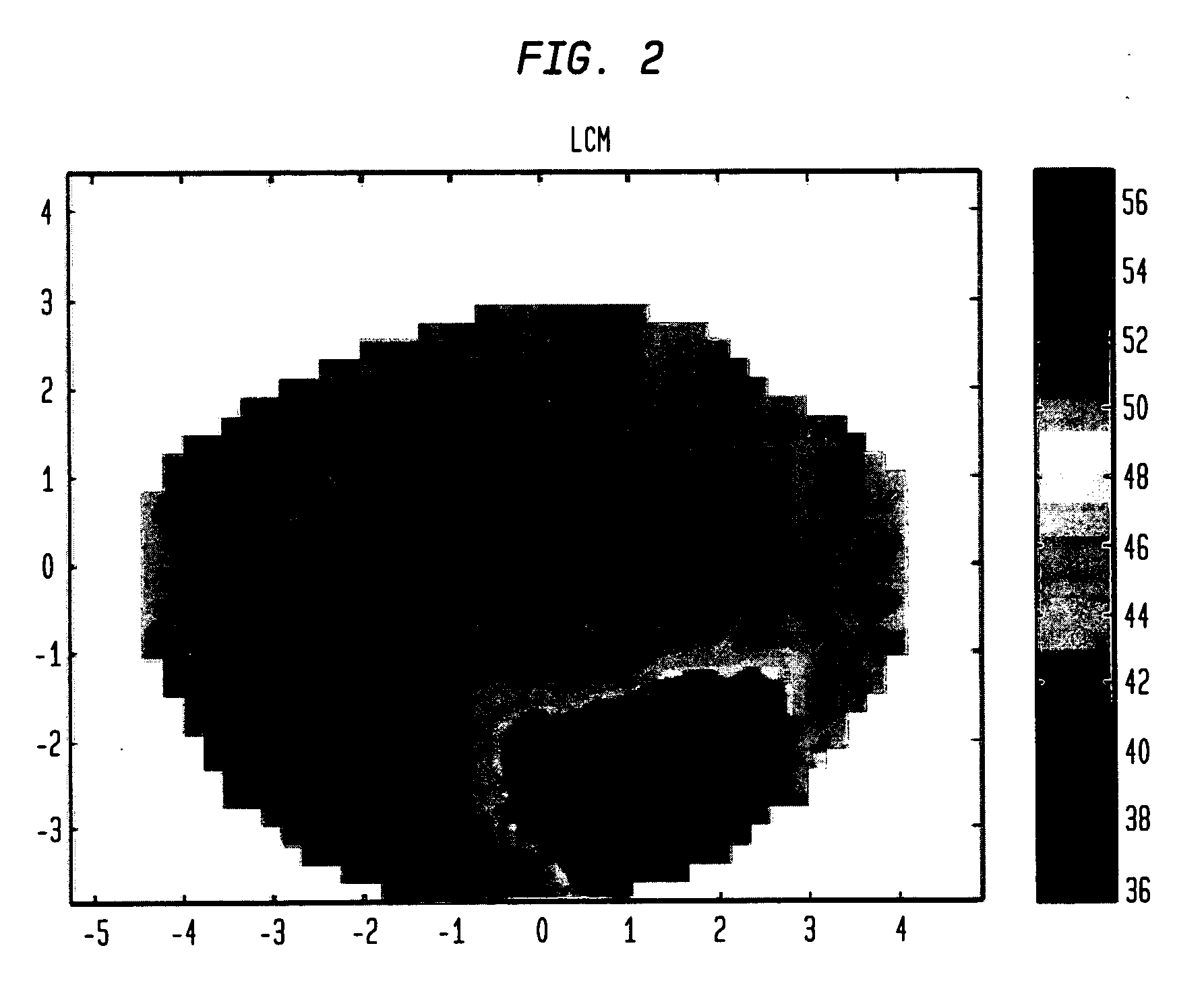 Local average curvature map for corneal topographers