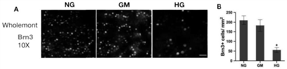 Method for constructing full-retina in-vitro culture model suffering from diabetes retinopathy