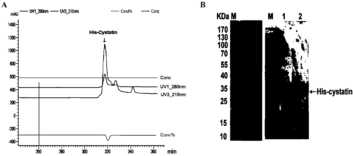 Antithrombotic polypeptide cystatin-T and preparation method and application thereof
