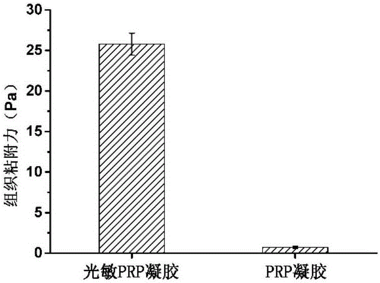Photosensitive PRP (platelet-rich plasma) gel and preparation method and application thereof