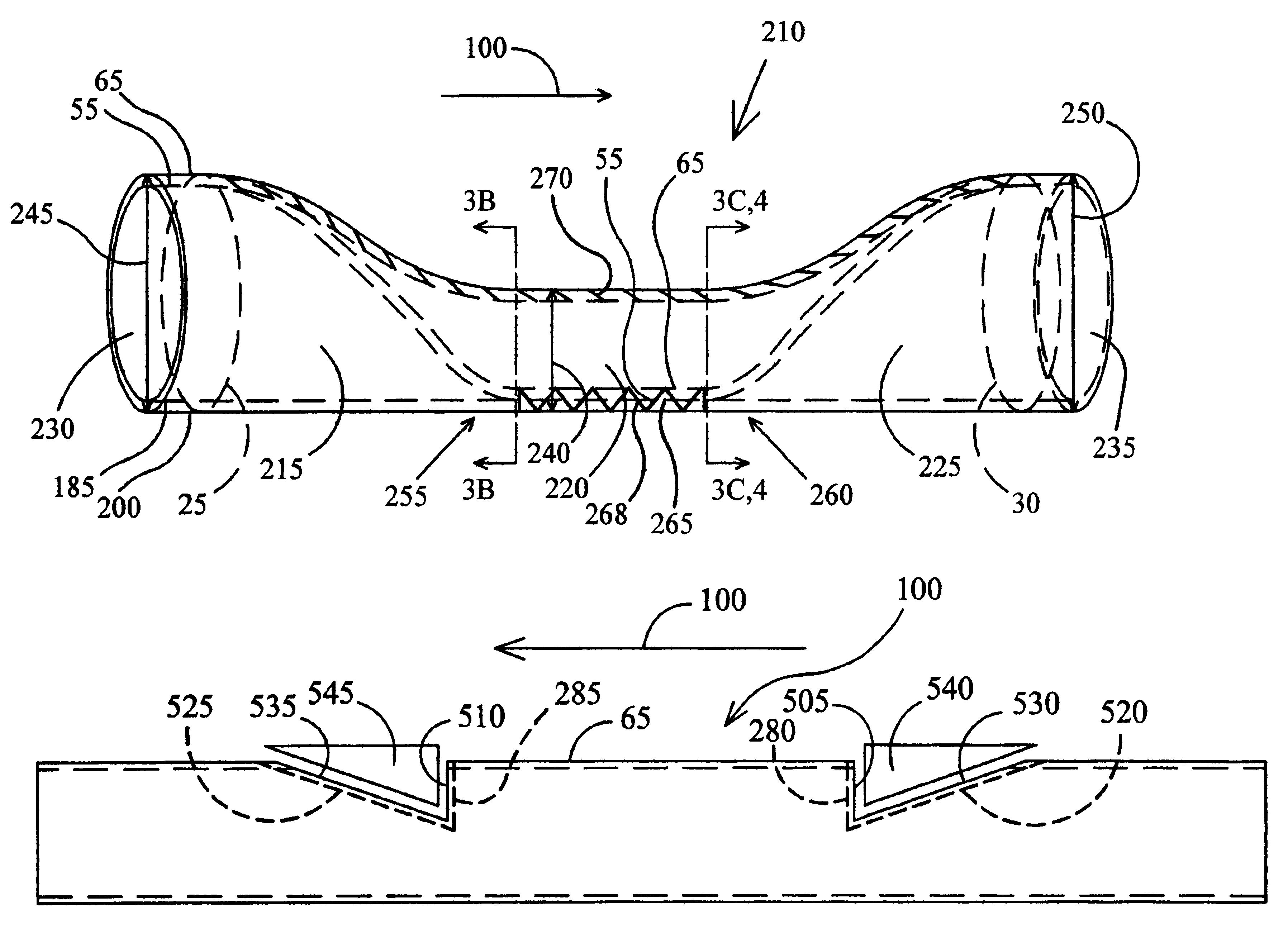 In situ venous valve device and method of formation