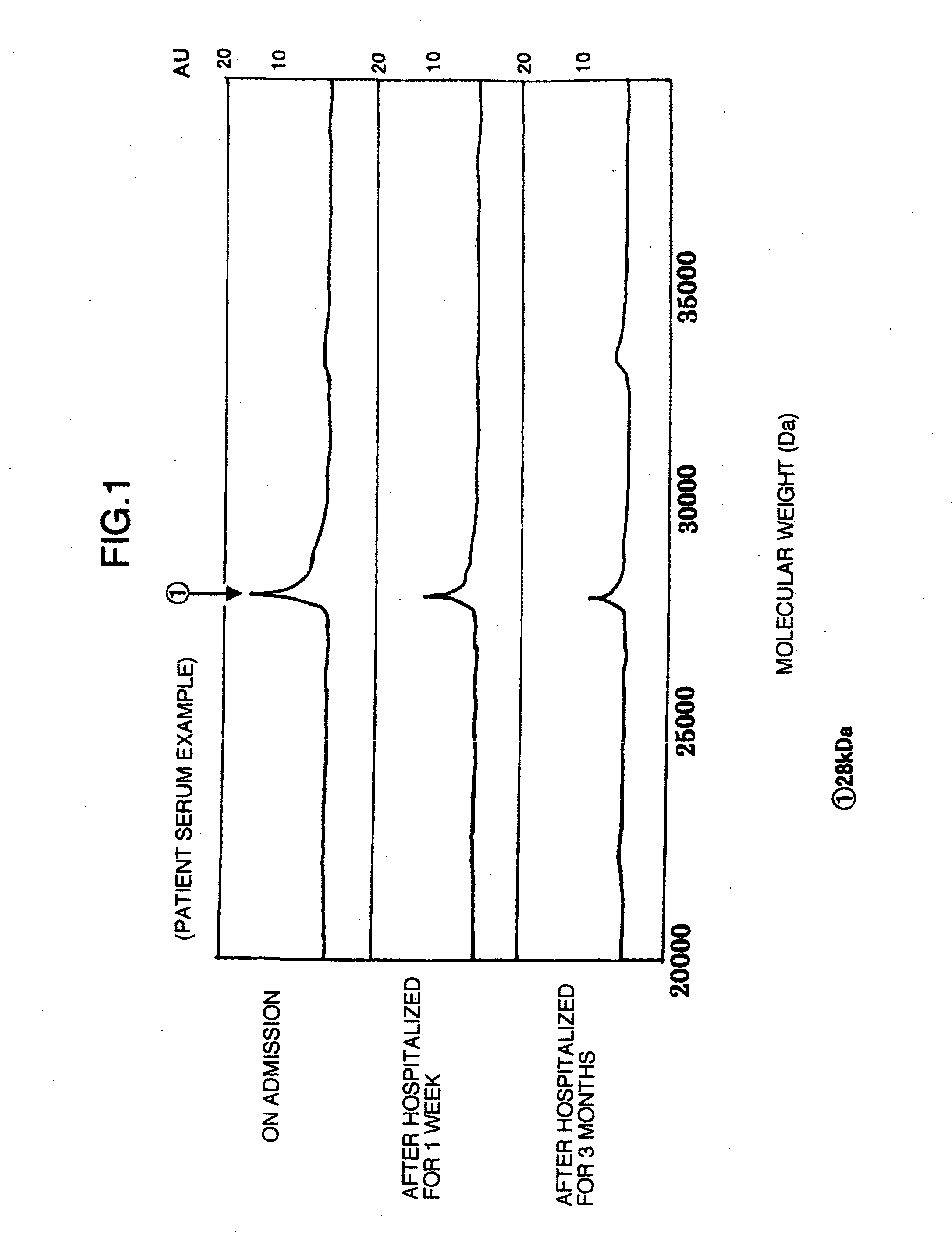 Marker proteins for diagnosing liver disease and method of diagnosing liver disease using the same