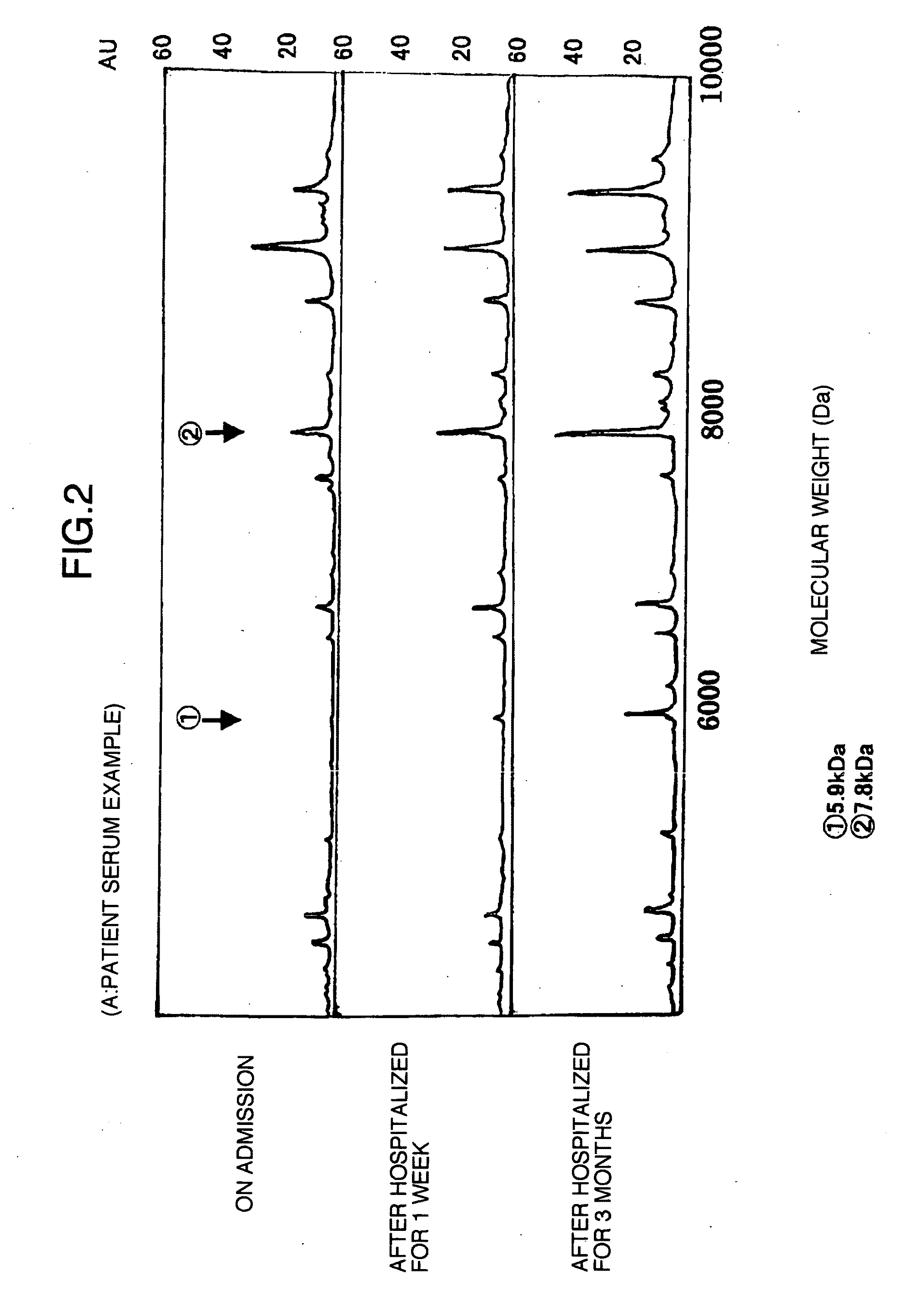 Marker proteins for diagnosing liver disease and method of diagnosing liver disease using the same