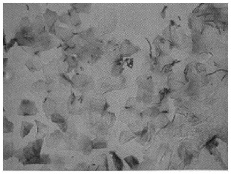 Sampling and staining method of epidermis fungi
