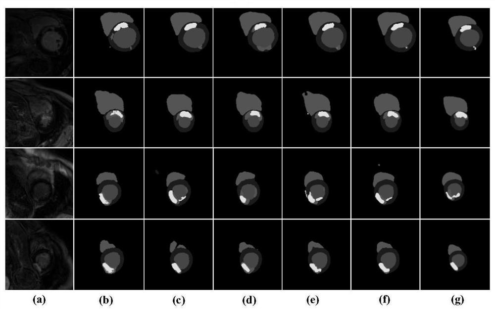 Heart MRI image multi-task segmentation method based on multi-modal complementary information exploration