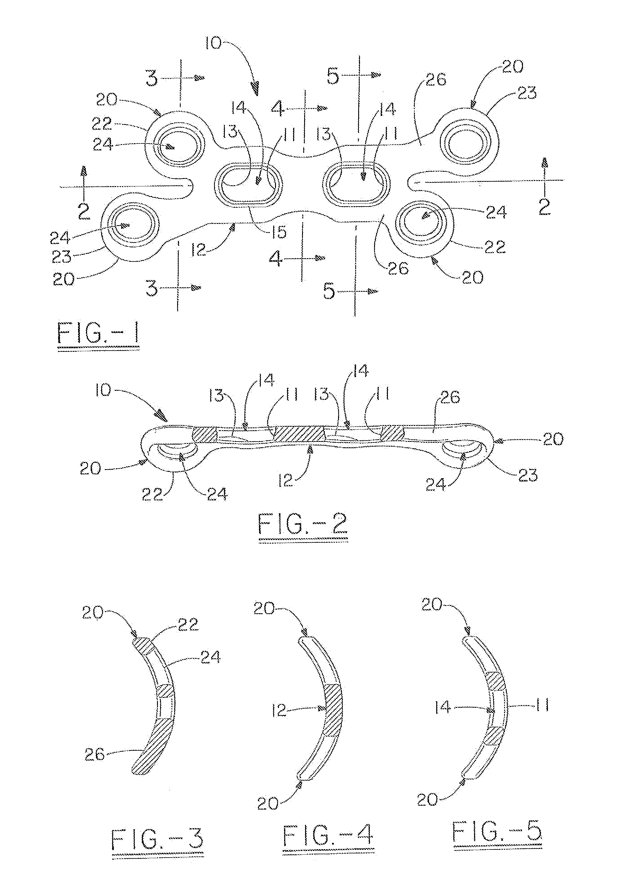 Orthopedic plate for use in fibula repair