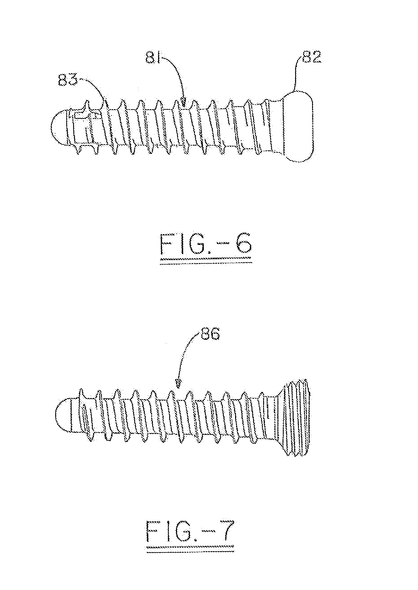 Orthopedic plate for use in fibula repair