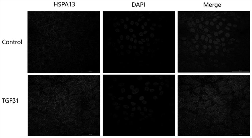 siRNA interfering with hspa13 expression and its application