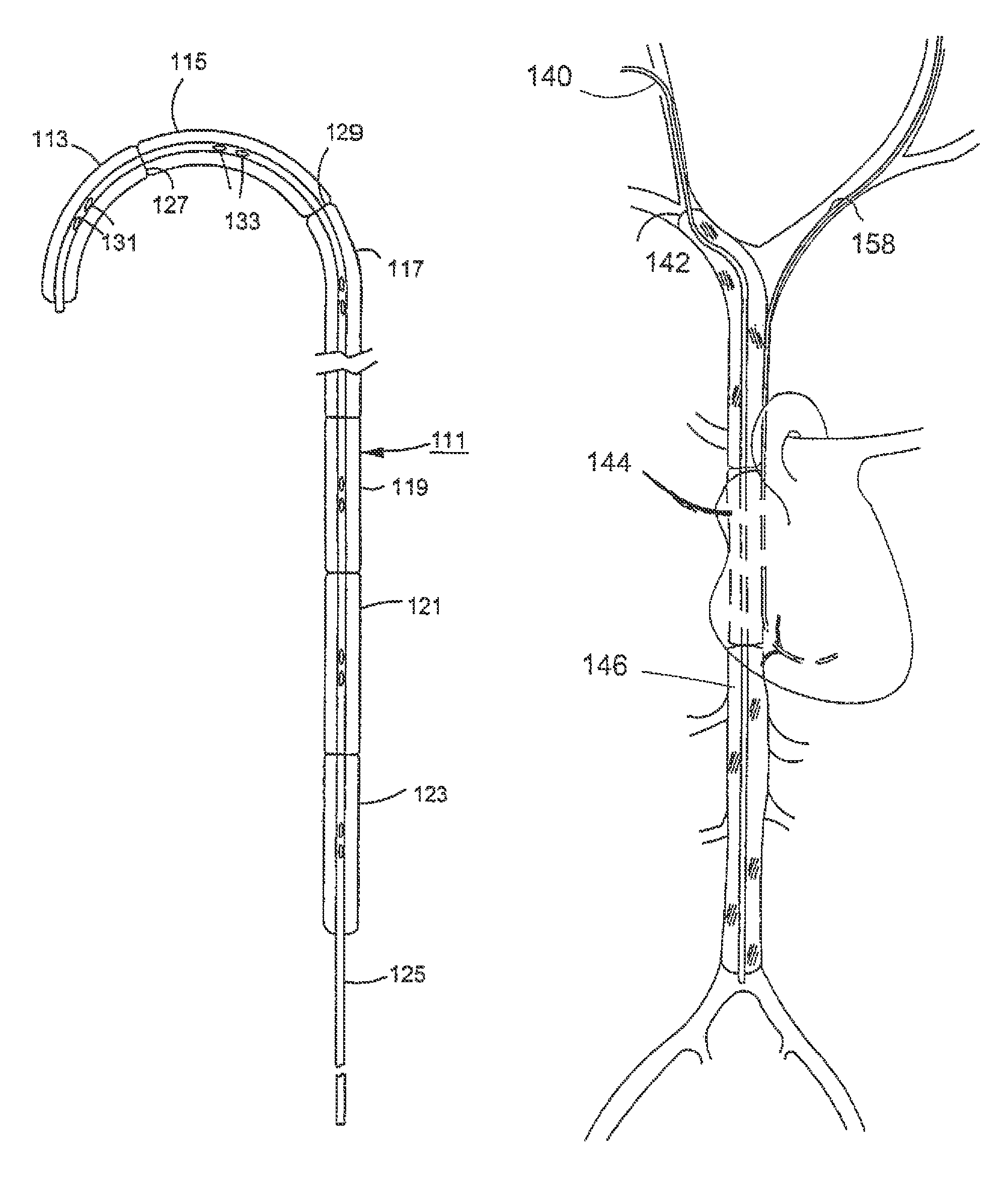 Method for delivering a macromolecular complex to muscle cells